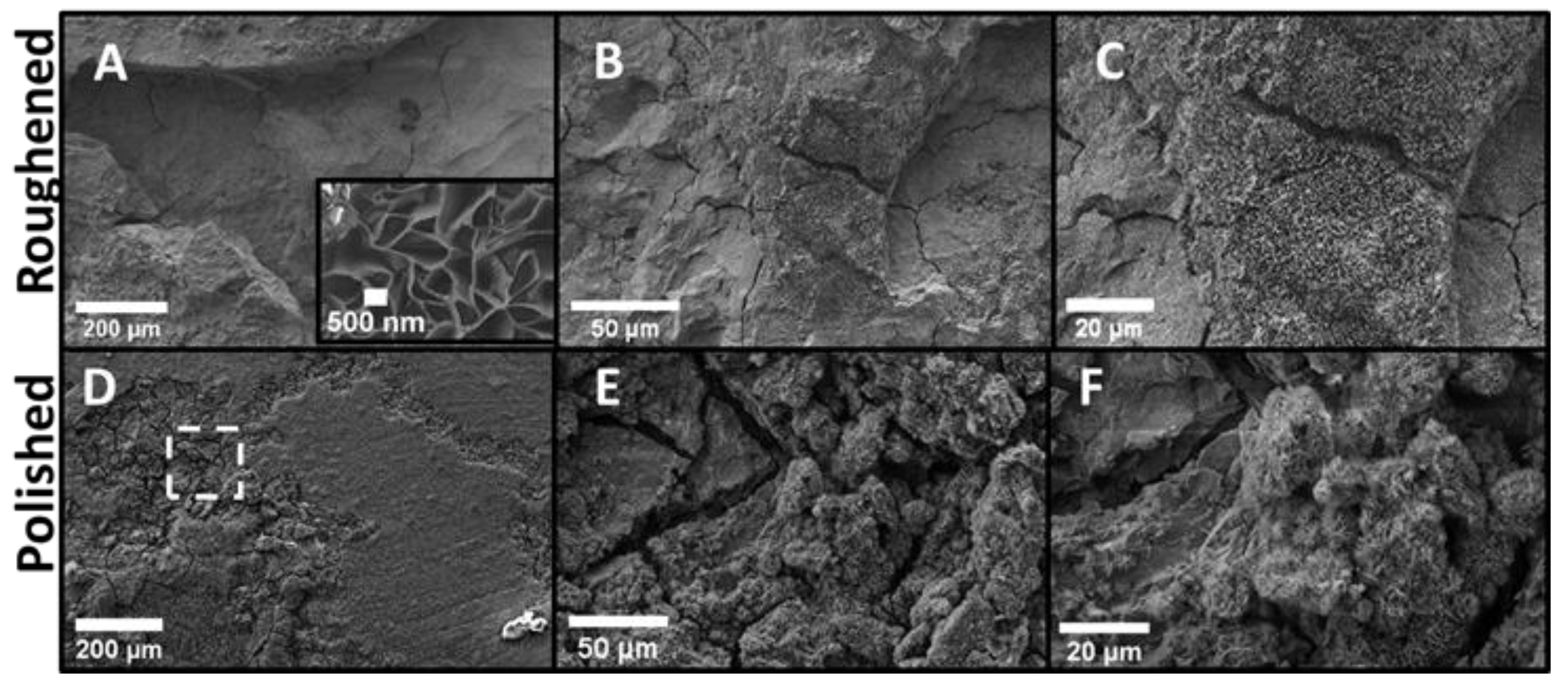 Metals 10 00651 g004