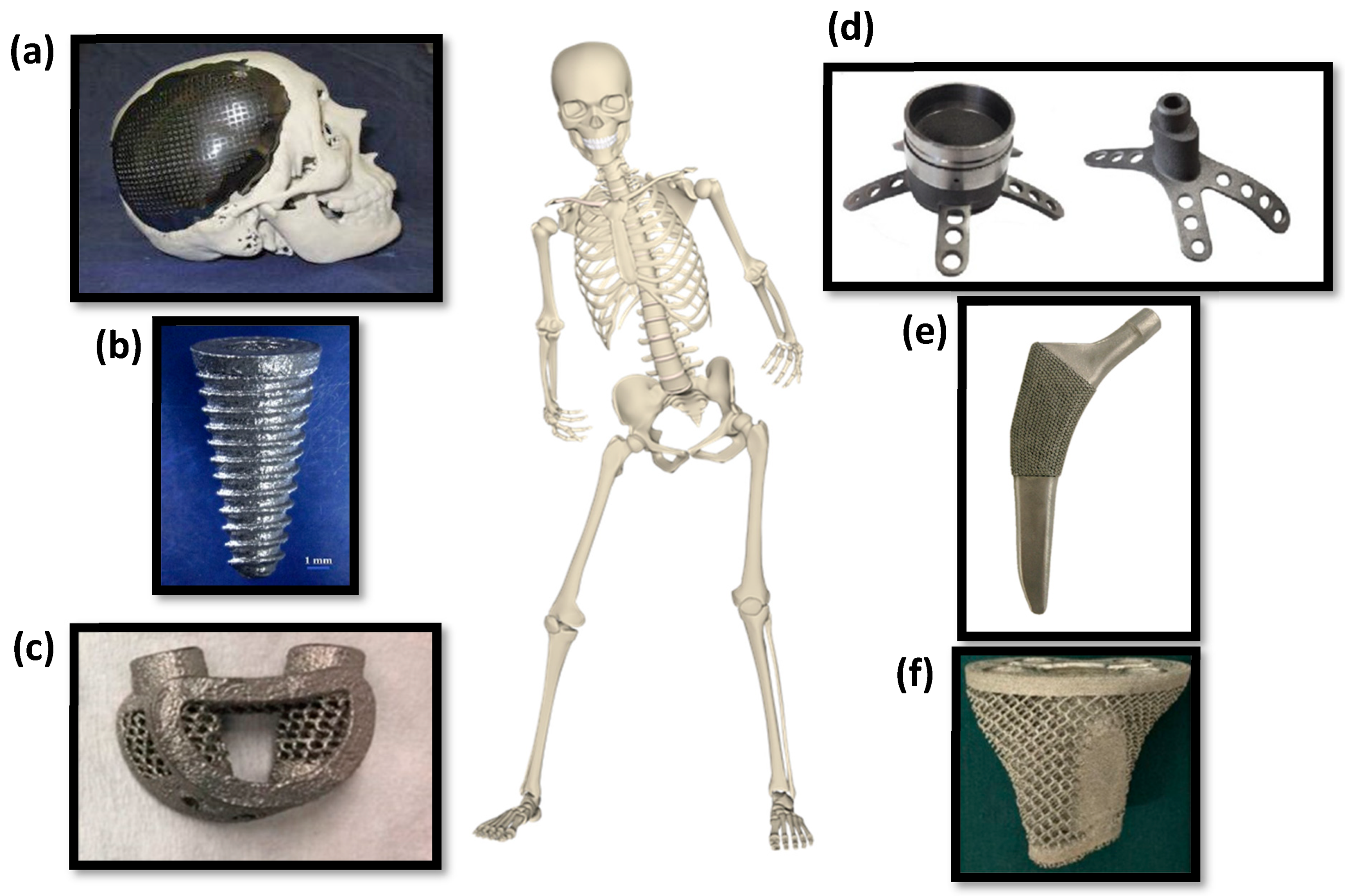 Metals 10 00686 g002