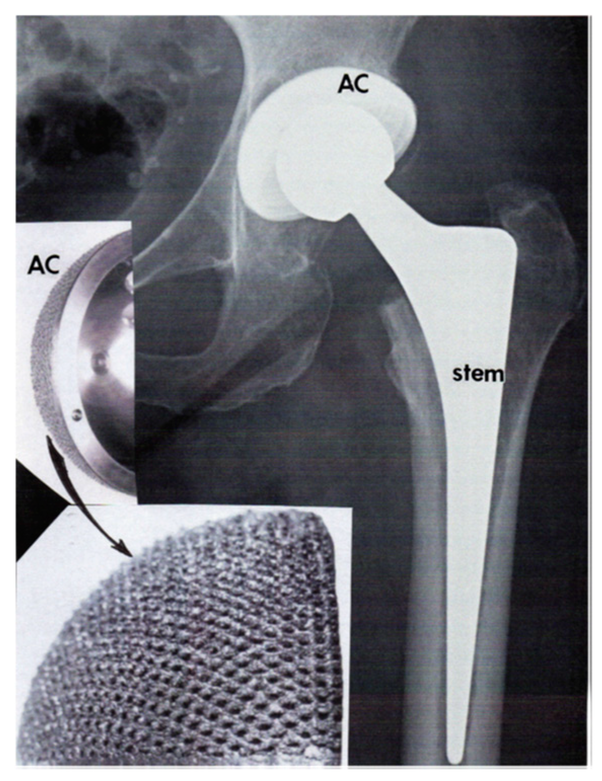 Metals 10 00686 g008