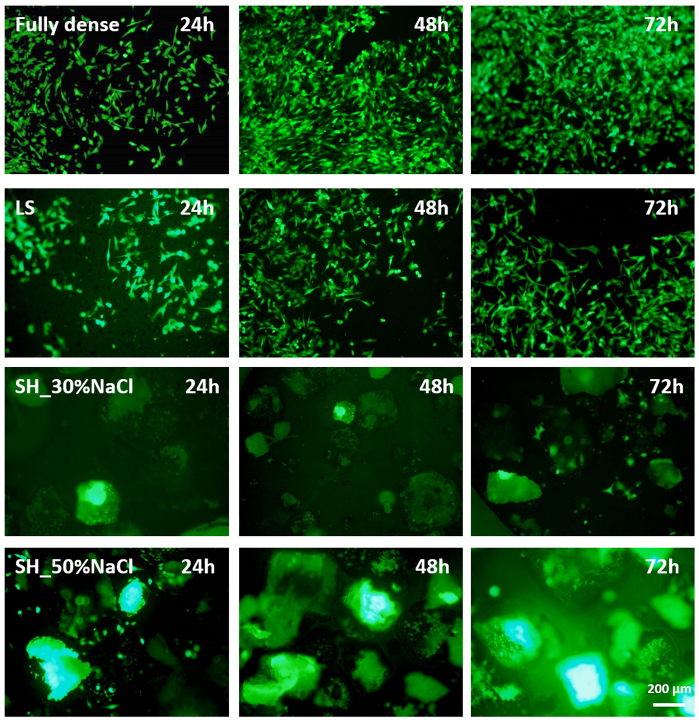Metals 10 00696 g004