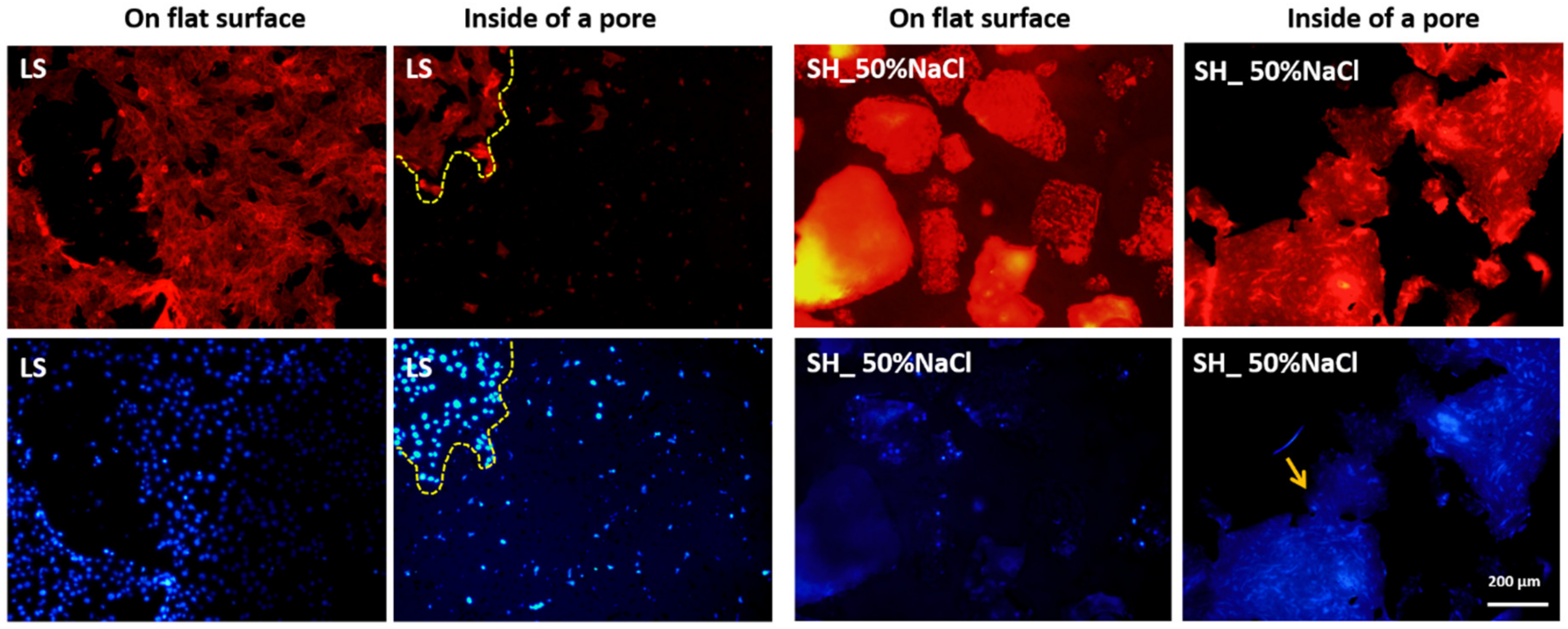 Metals 10 00696 g007