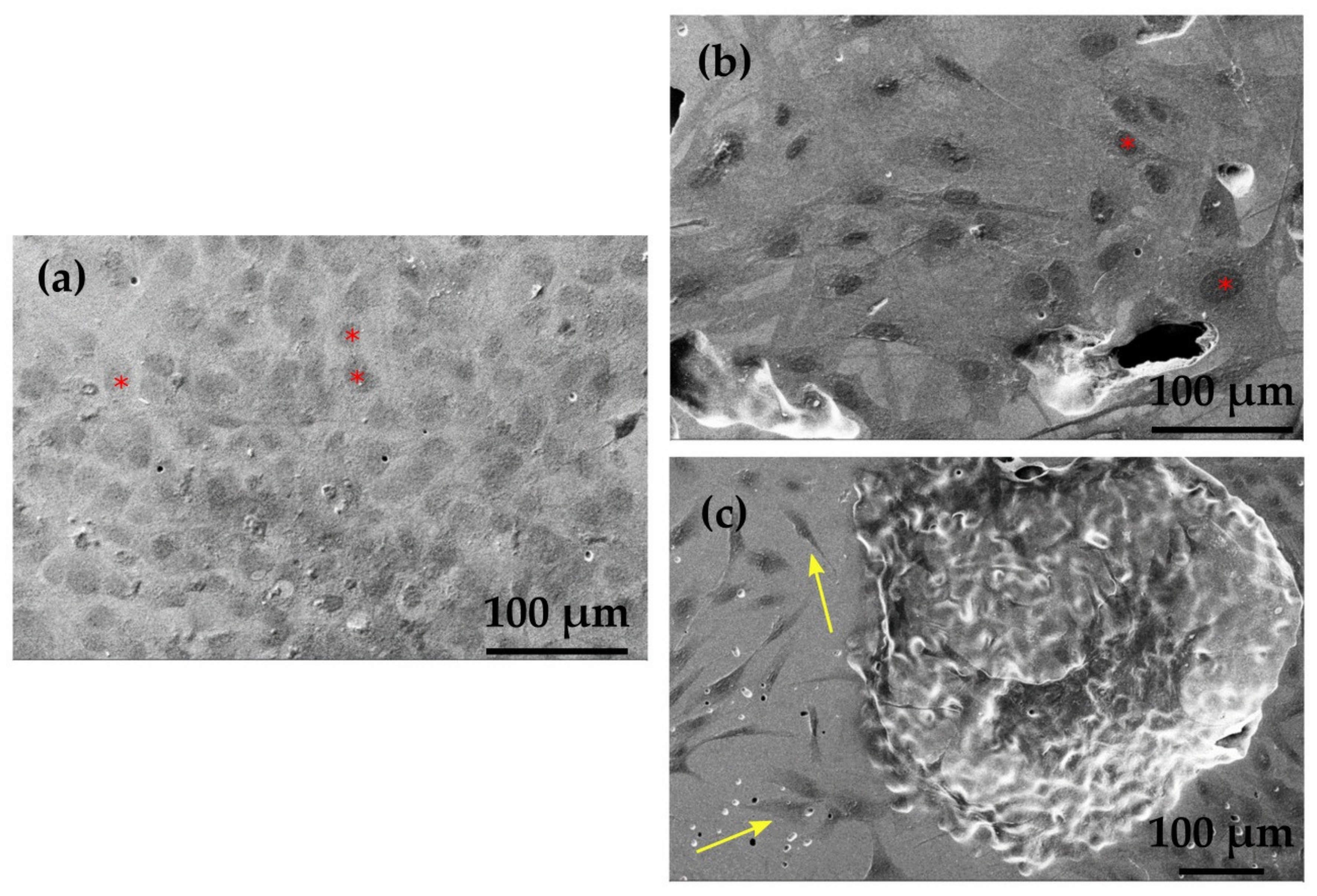 Metals 10 00748 g008