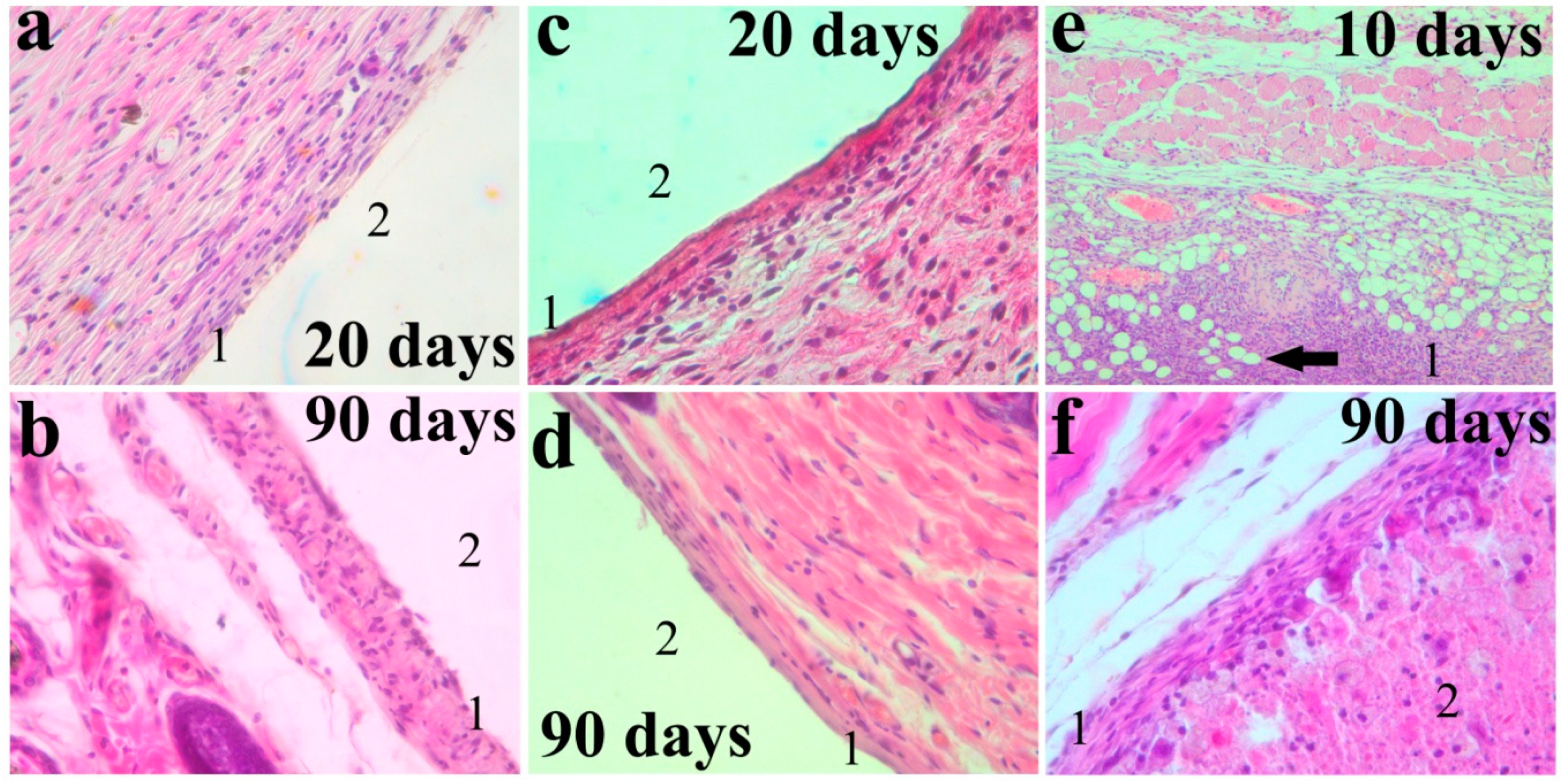 Metals 10 00867 g005