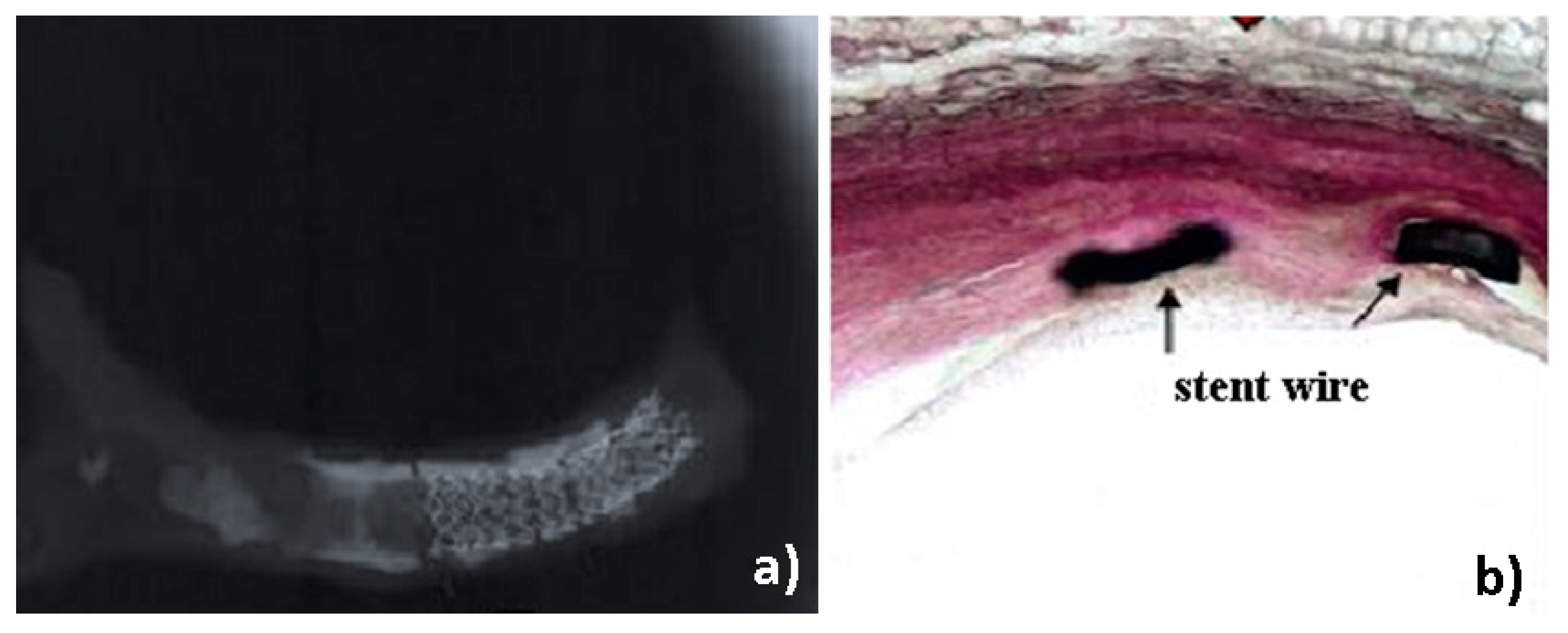Metals 10 01112 g011