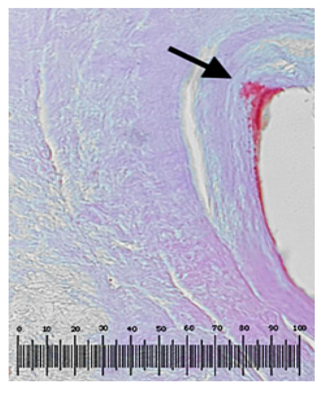 Metals 10 01112 g012