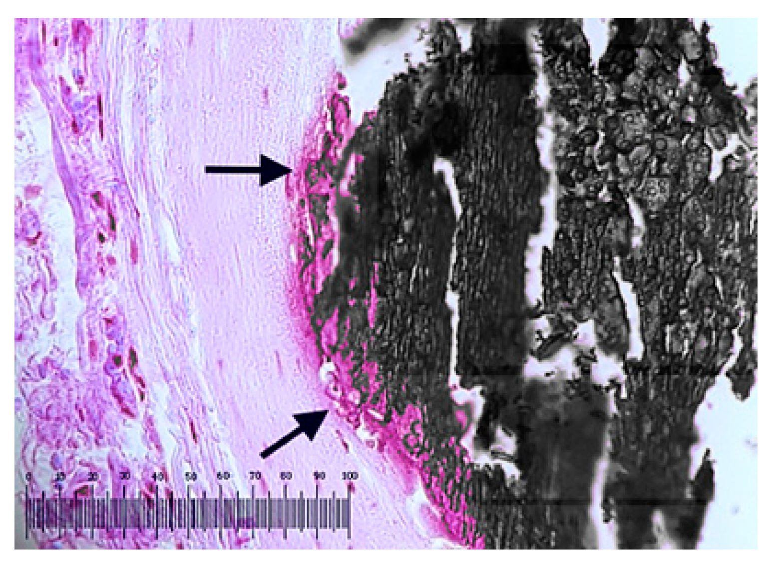 Metals 10 01112 g013