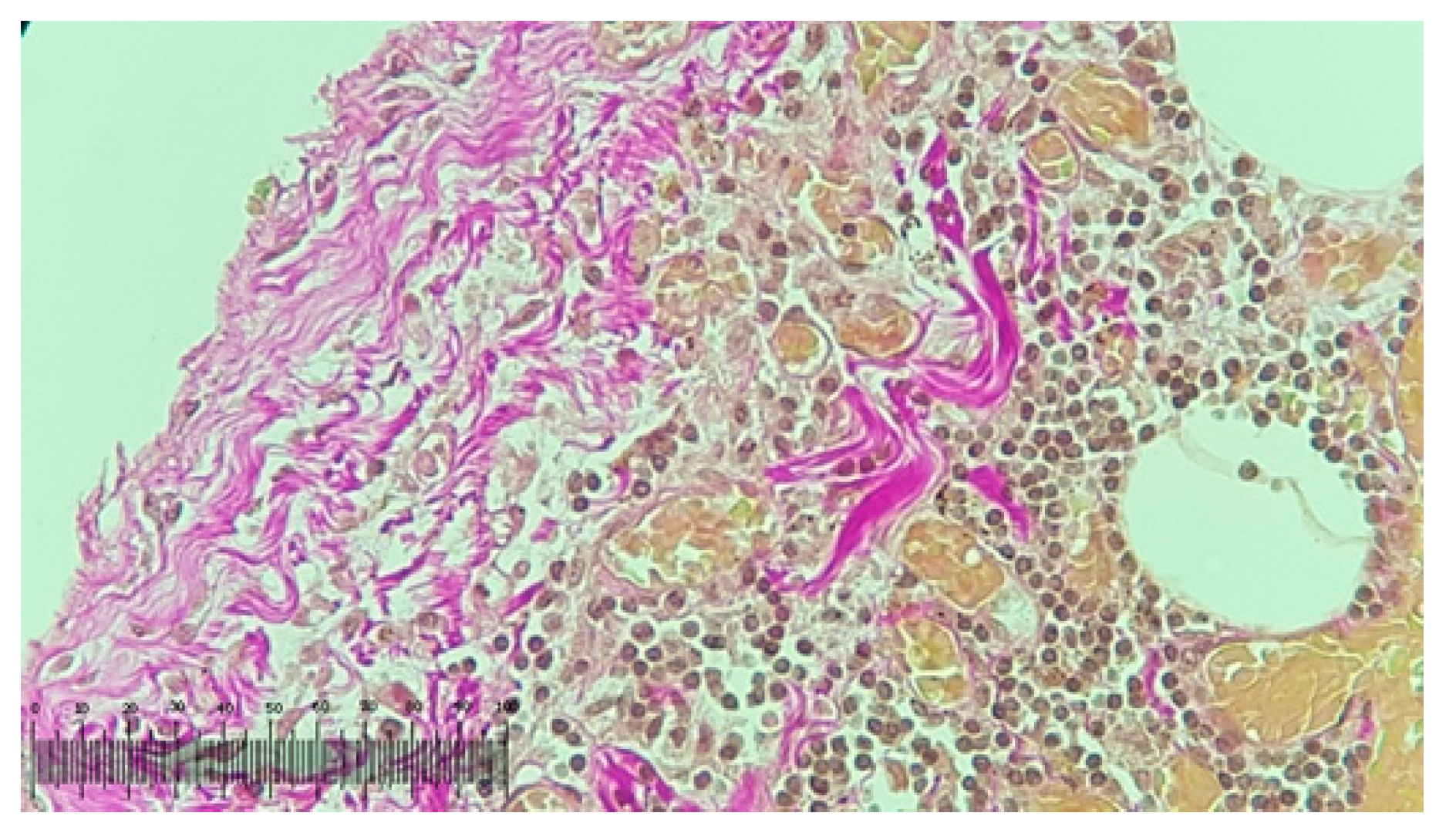 Metals 10 01112 g014