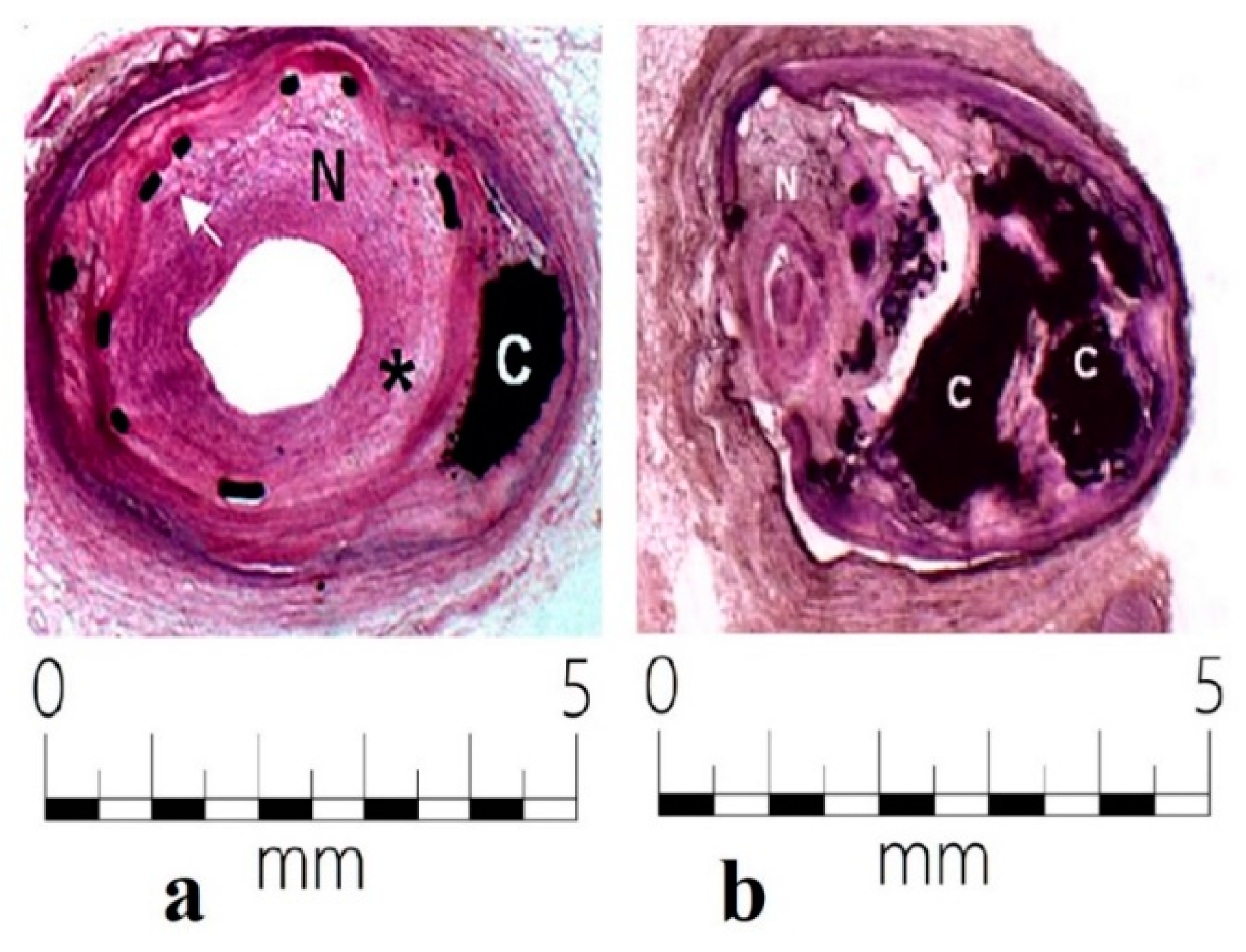 Metals 10 01112 g015