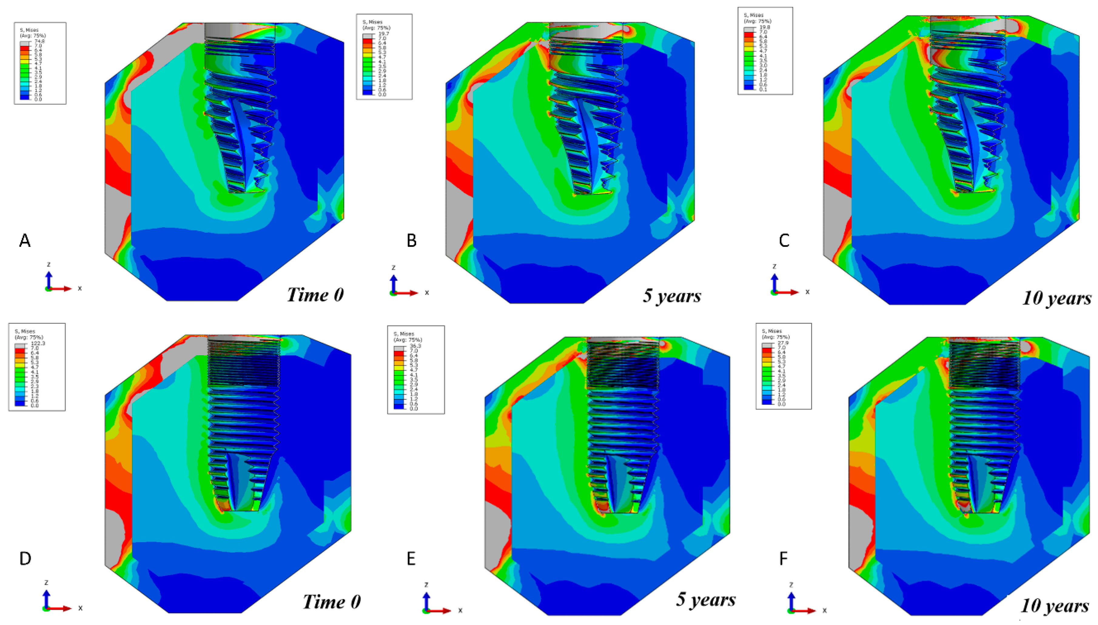 Metals 10 01132 g004 Metals 10 01132 g004