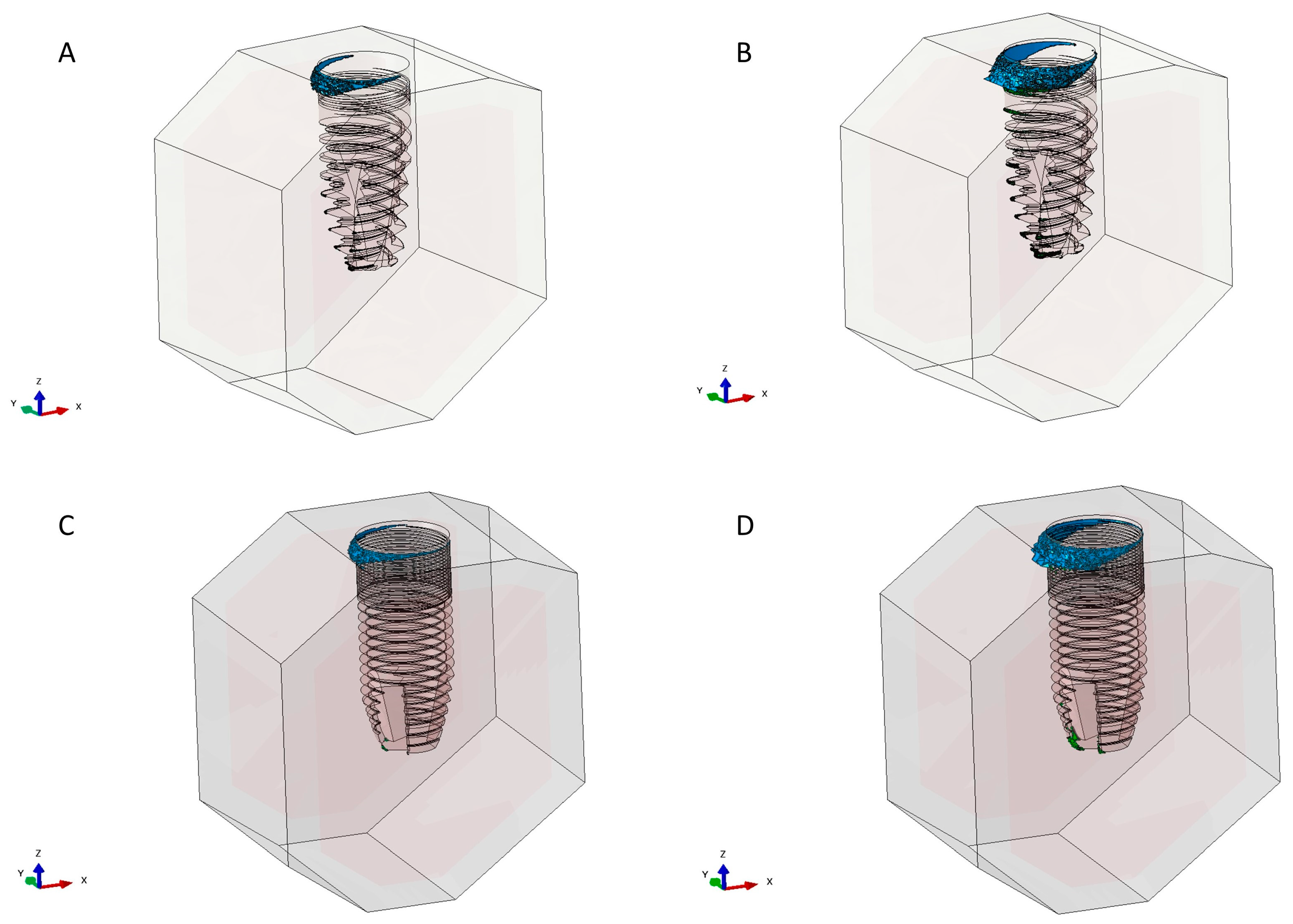 Metals 10 01132 g005 Metals 10 01132 g005