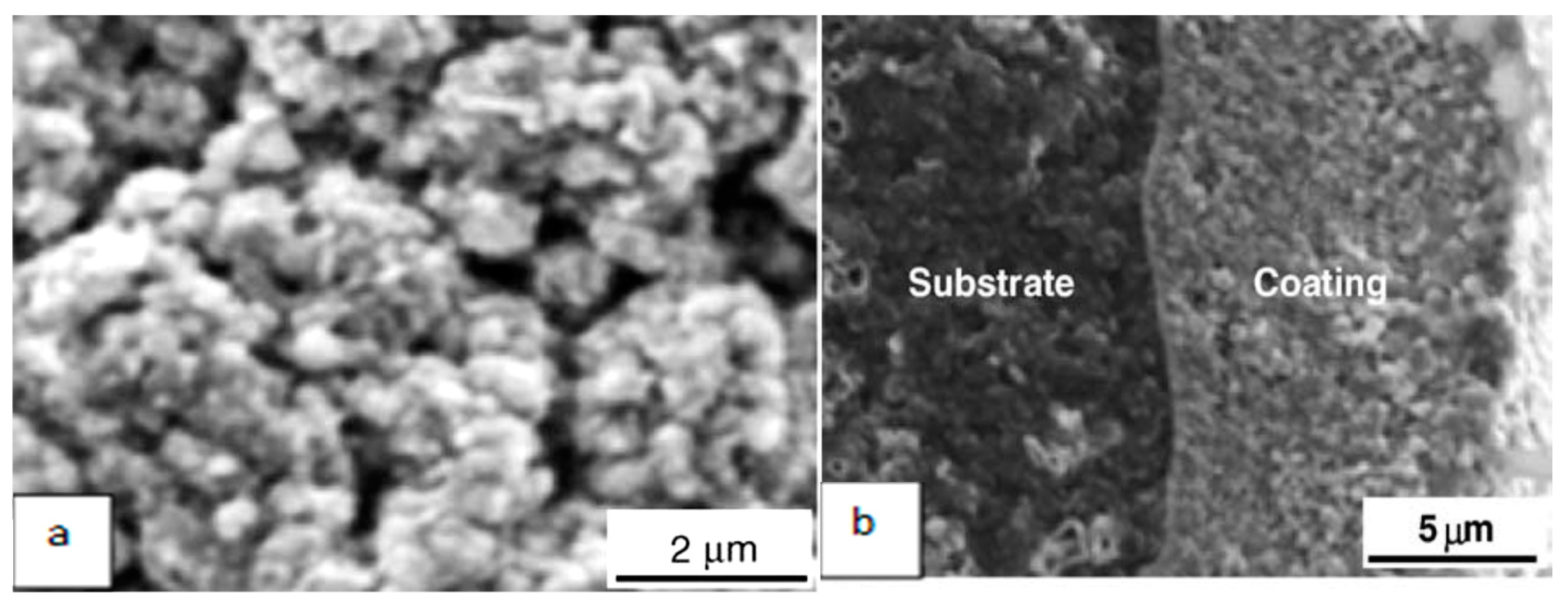 Metals 10 01171 g006