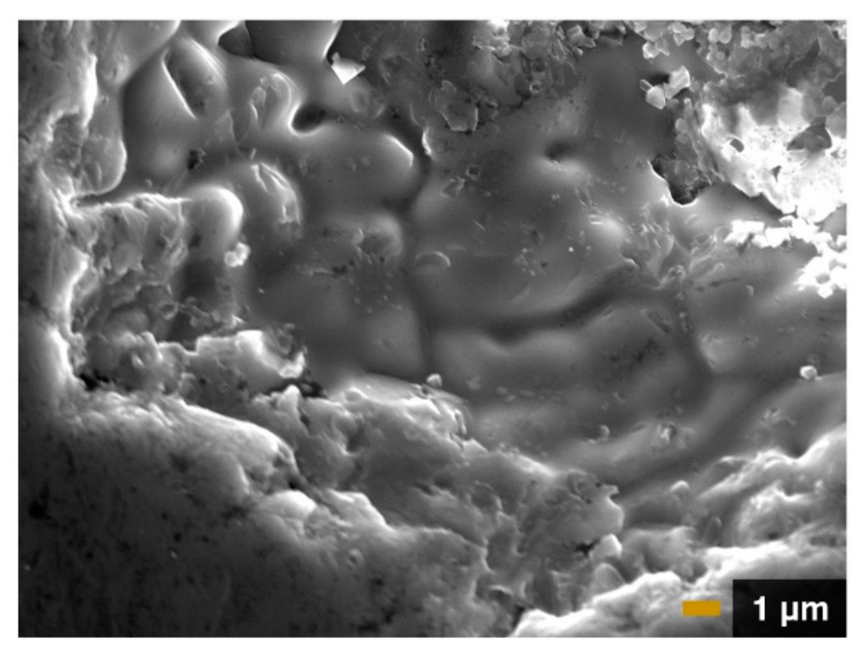 Metals 10 01505 g004