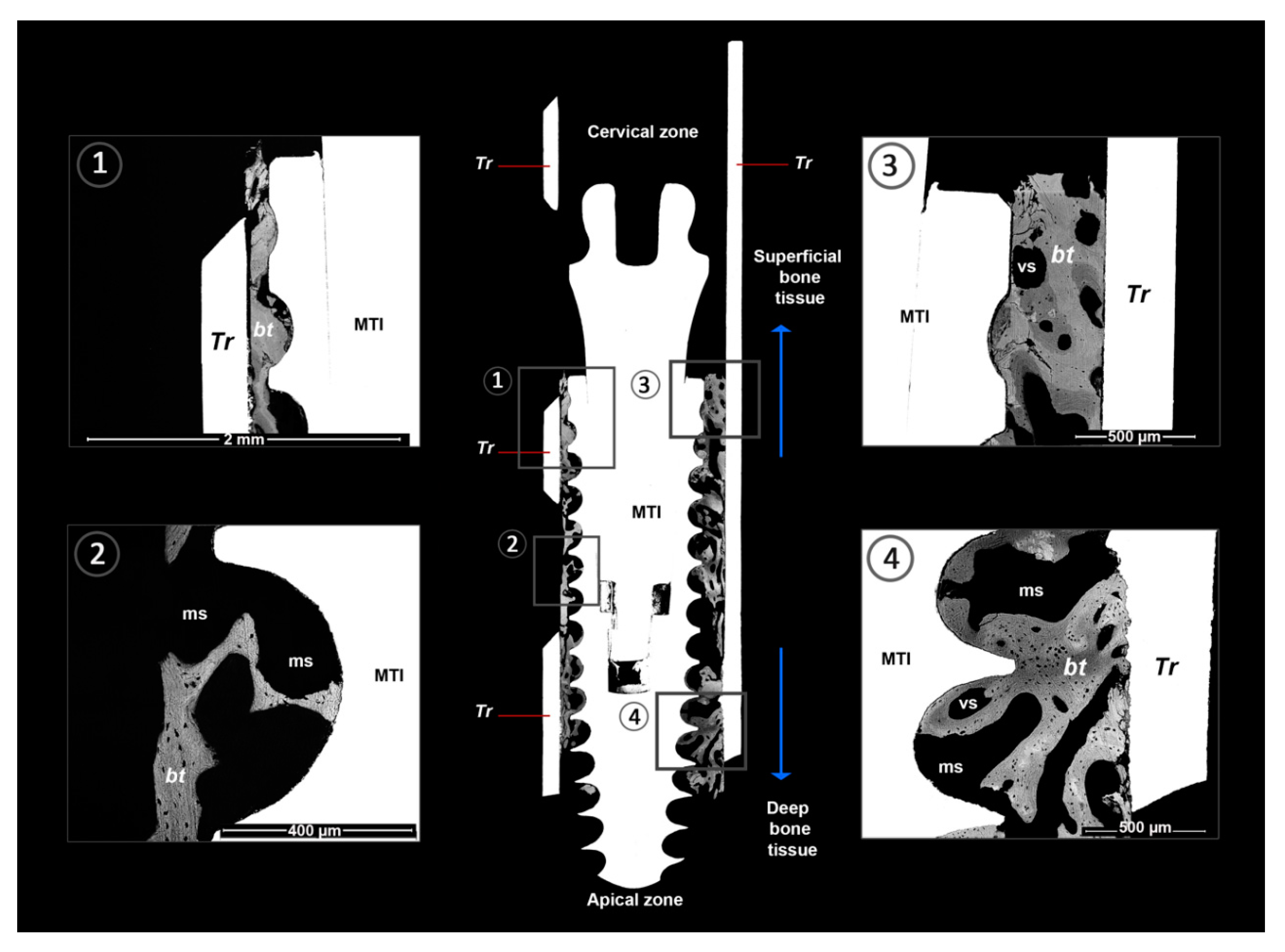 Metals 11 00002 g003 Metals 11 00002 g003