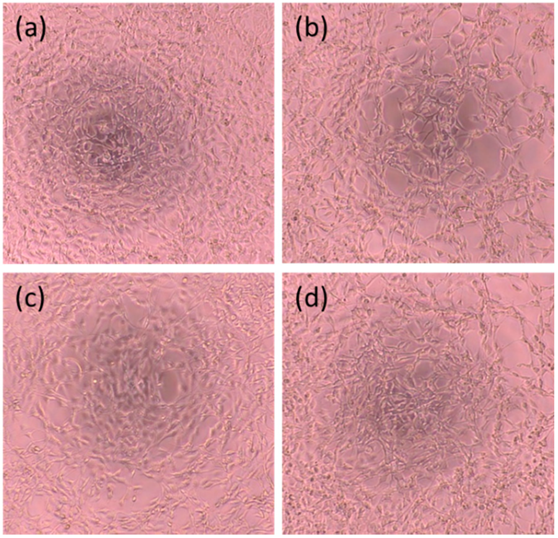 Metals 11 00023 g008