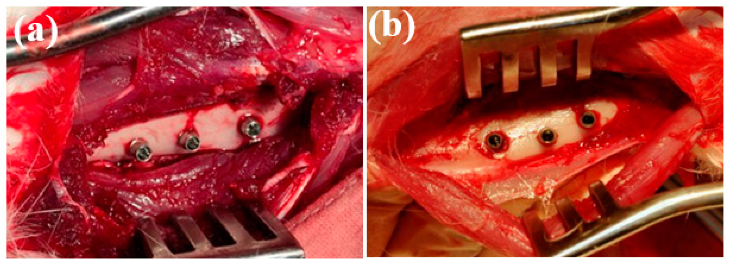 Metals 11 00106 g006