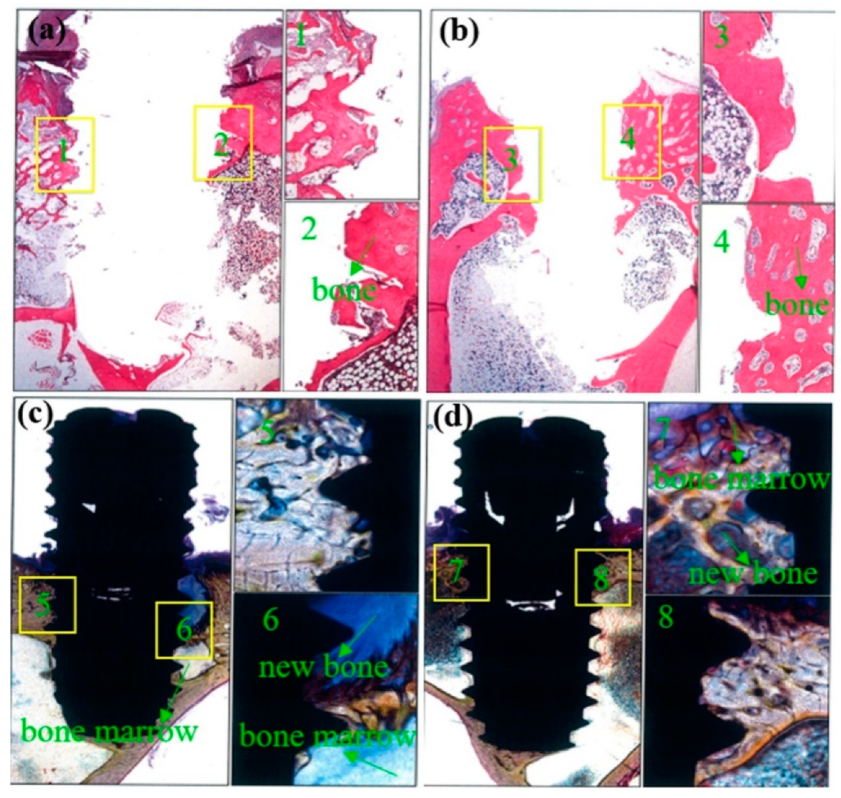 Metals 11 00106 g007