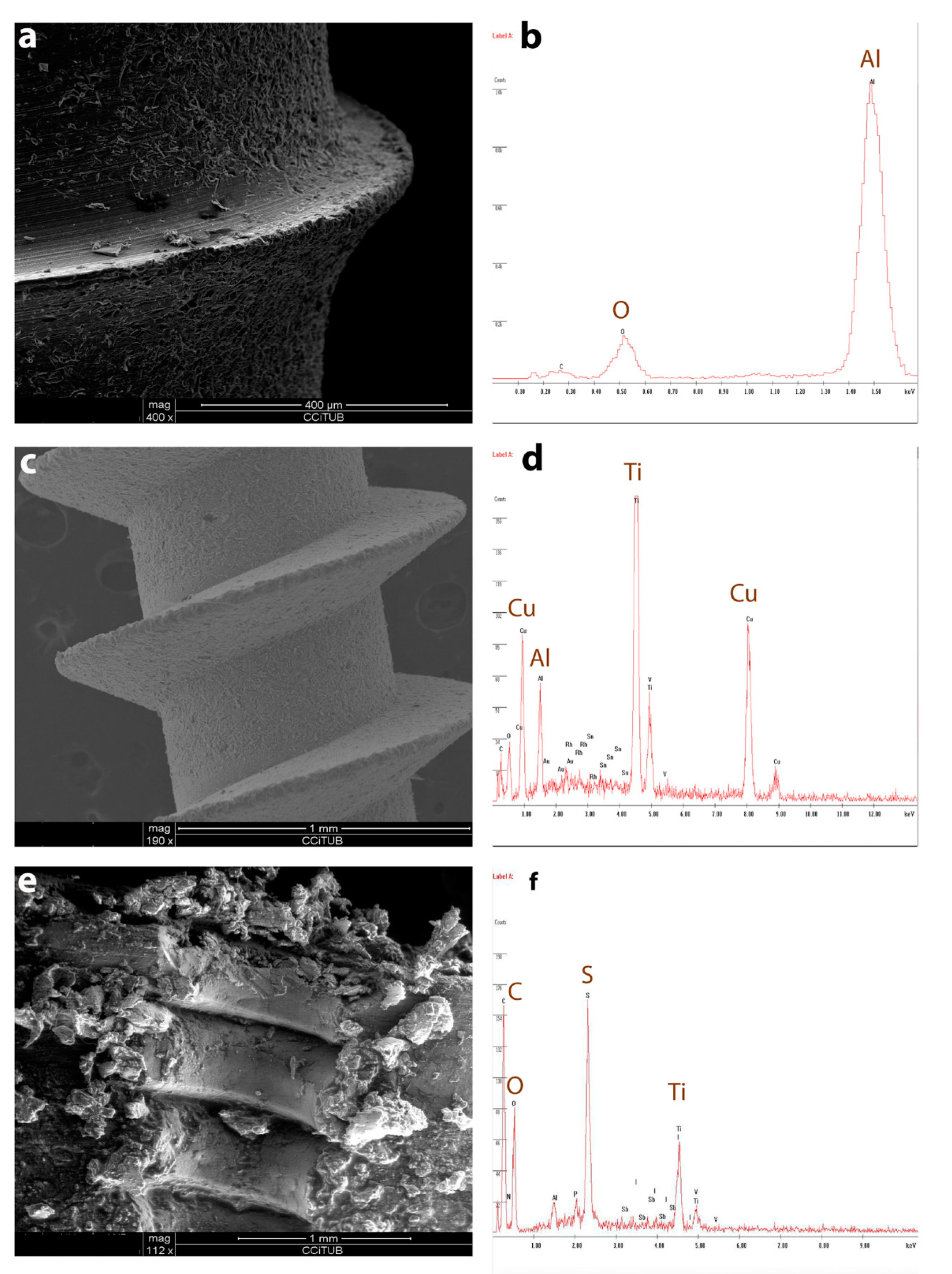 Metals 11 00245 g004