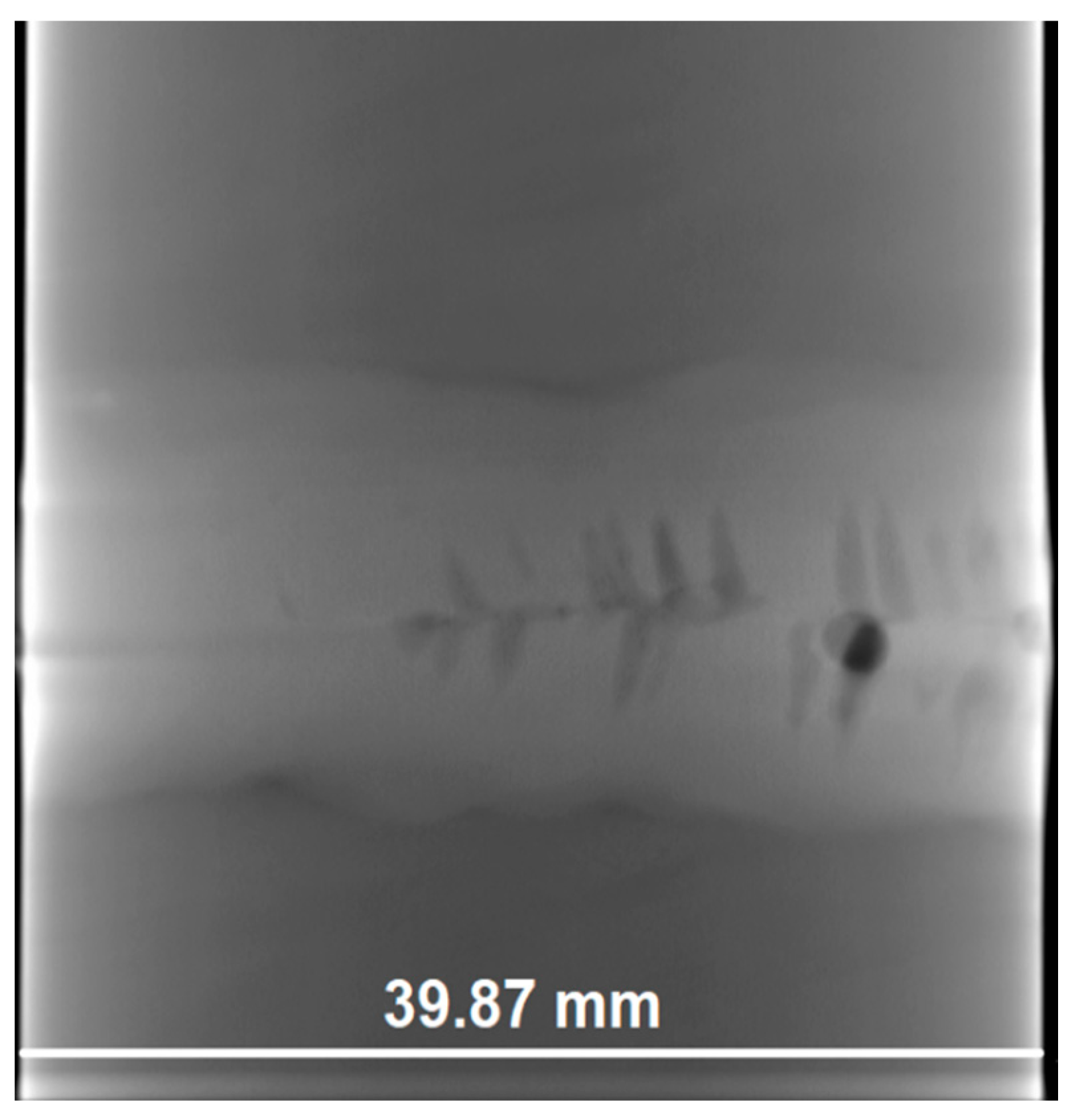 Metals 11 00444 g003