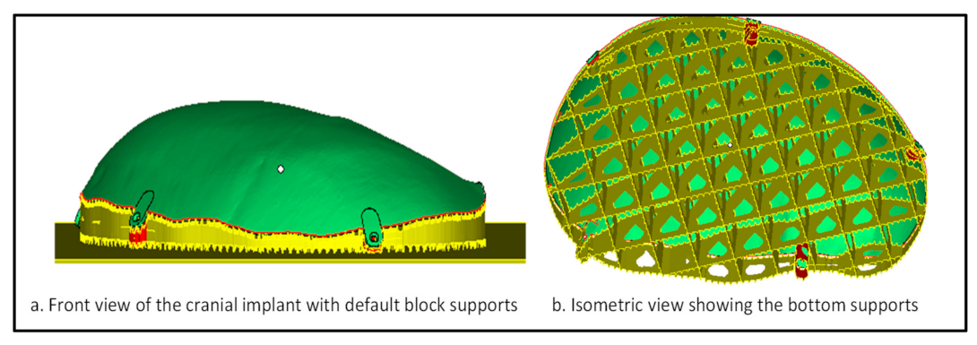 Metals 11 00496 g004