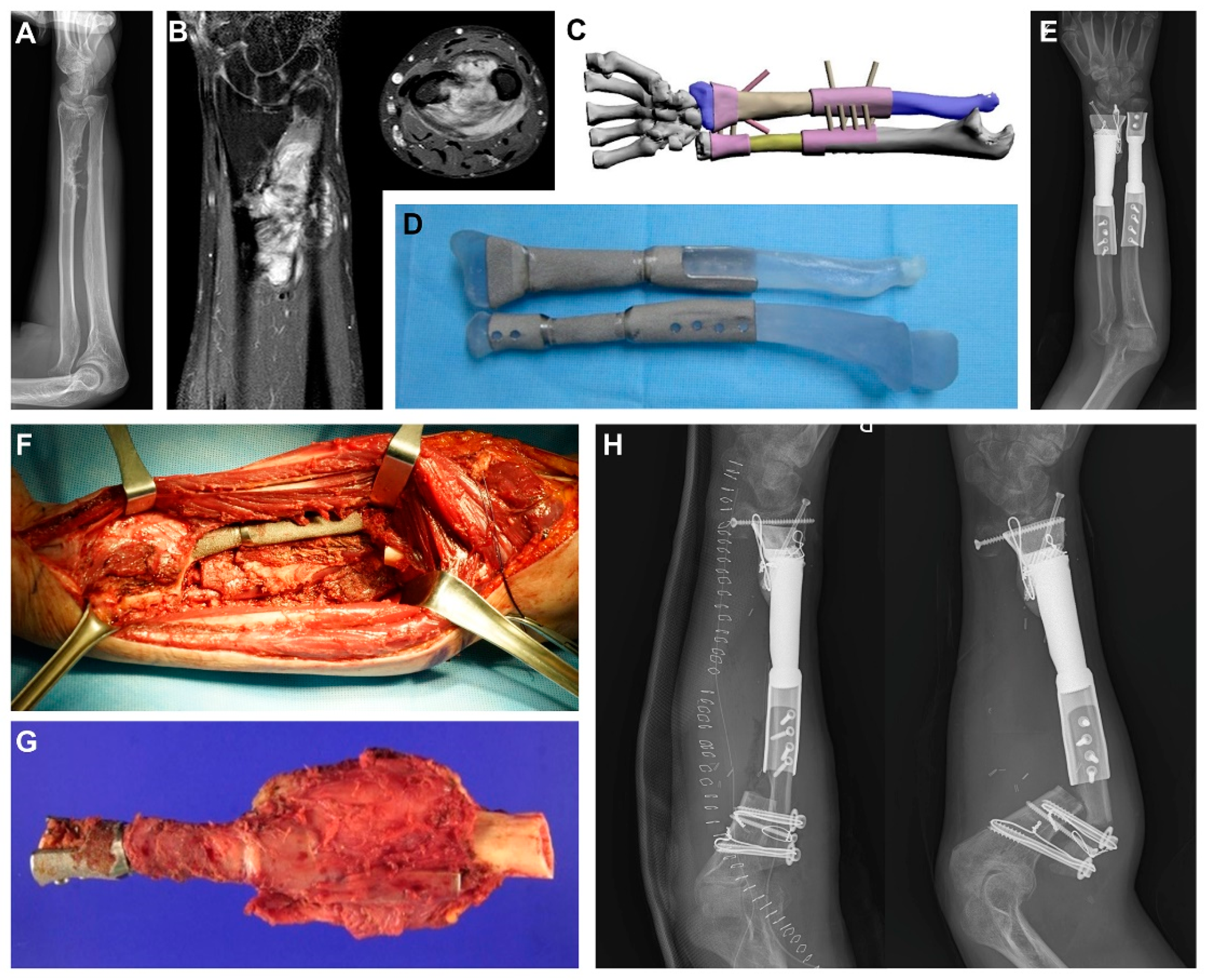 Metals 11 00707 g001 Metals 11 00707 g001