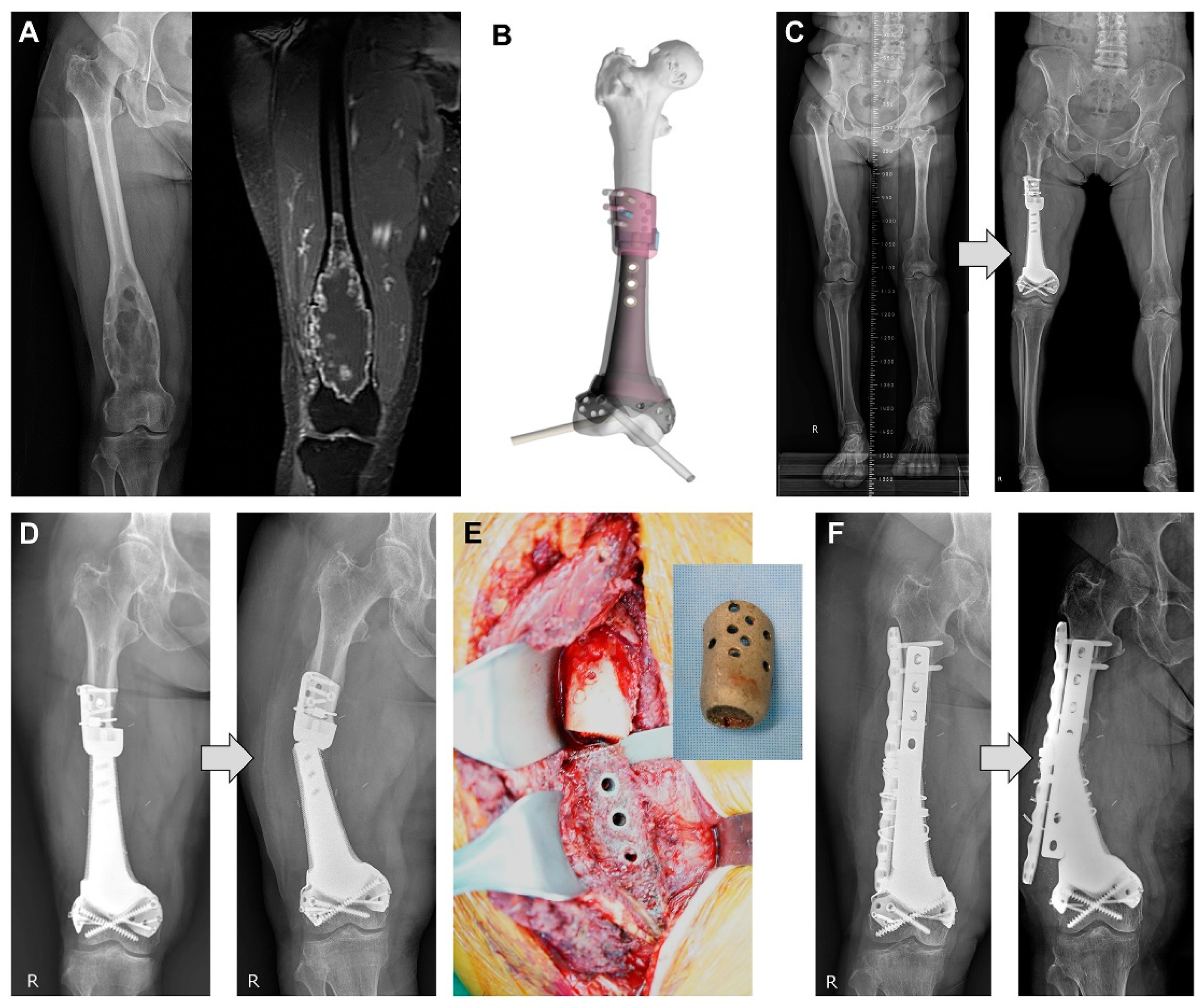 Metals 11 00707 g002 Metals 11 00707 g002