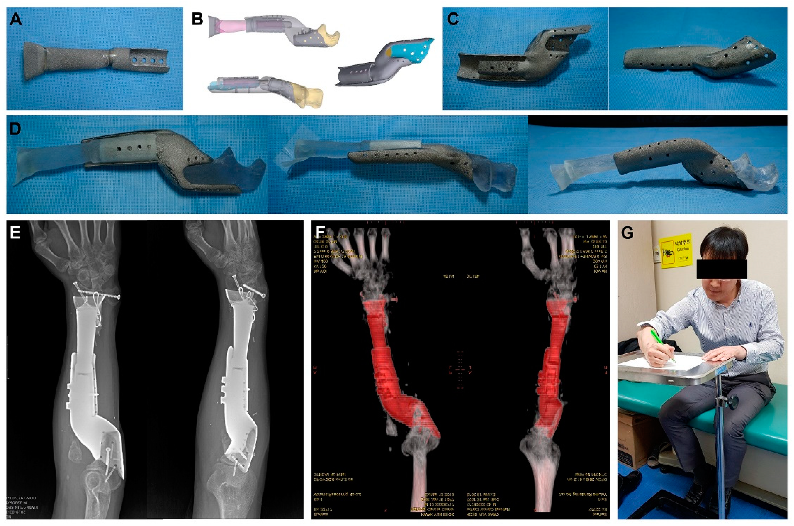 Metals 11 00707 g003 Metals 11 00707 g003