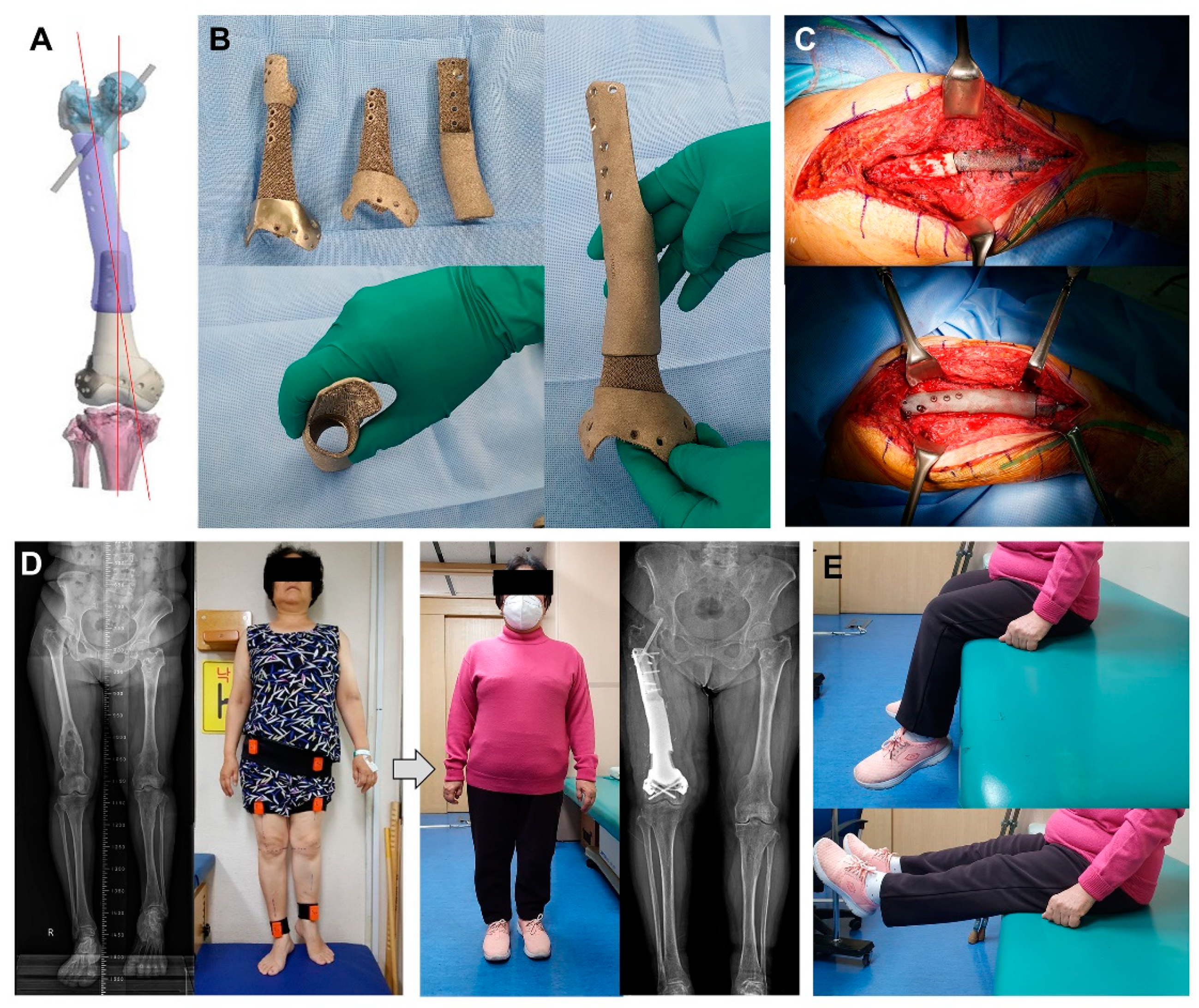 Metals 11 00707 g004 Metals 11 00707 g004