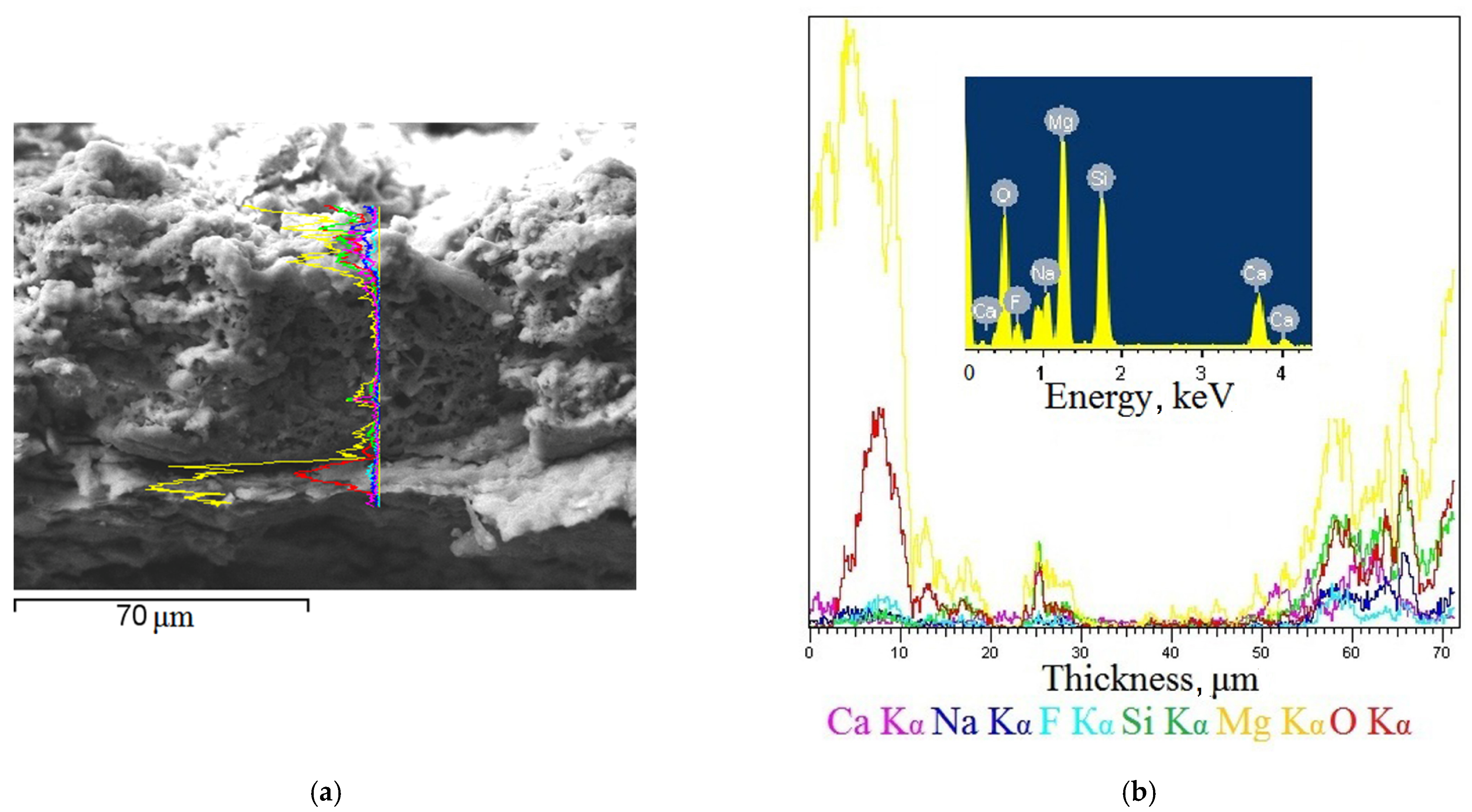 Metals 11 00754 g005