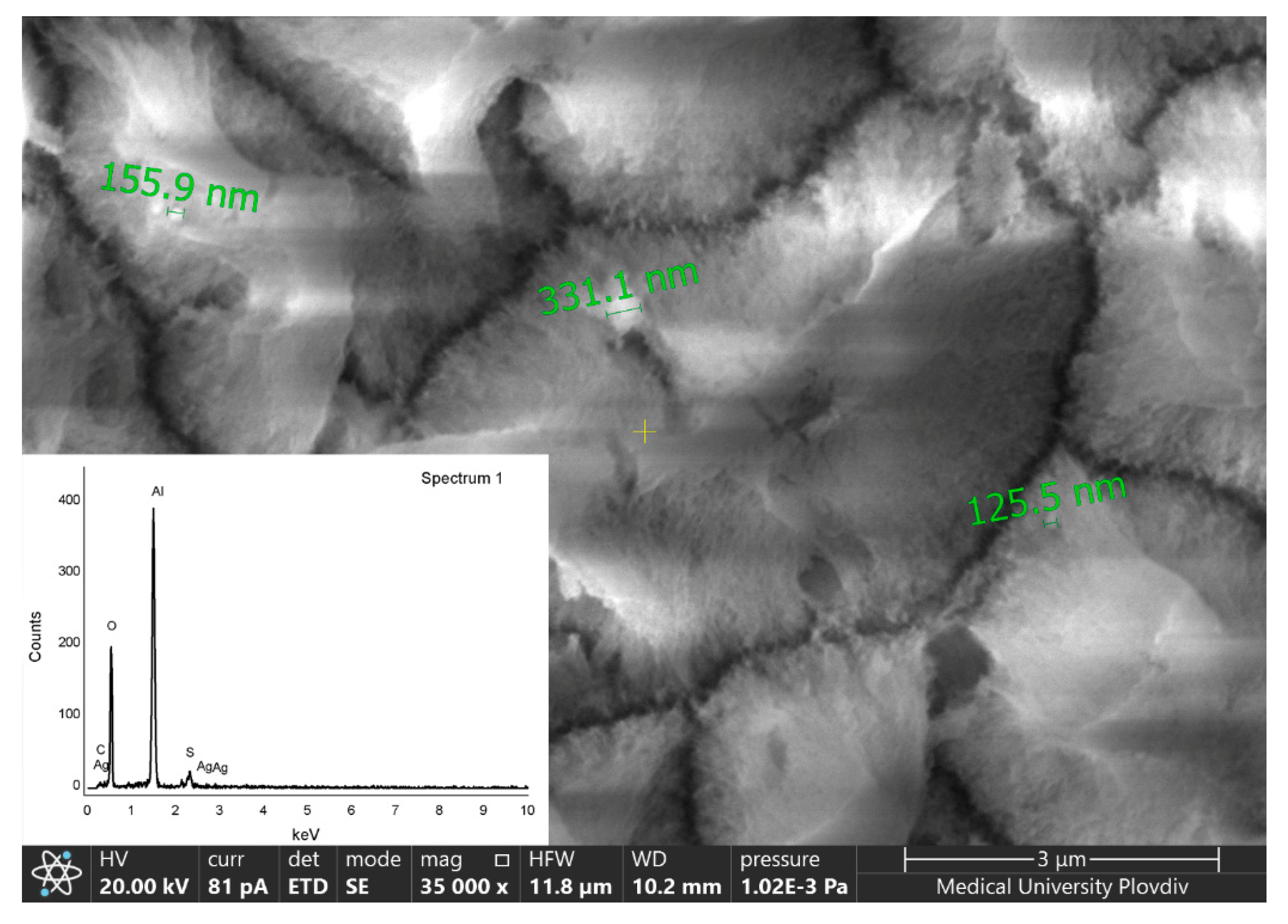 Metals 12 00051 g004