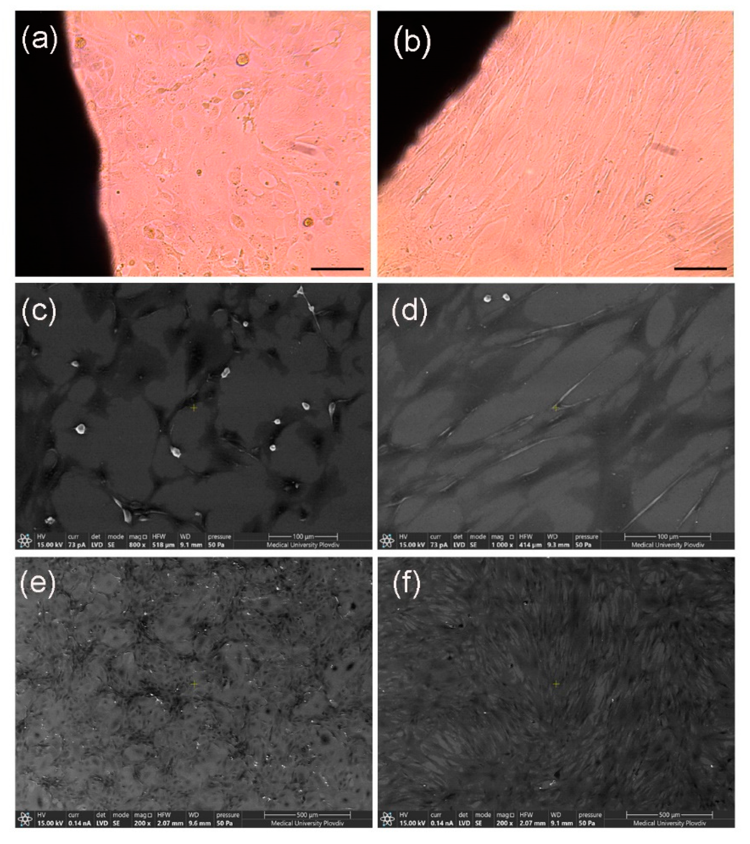 Metals 12 00051 g006