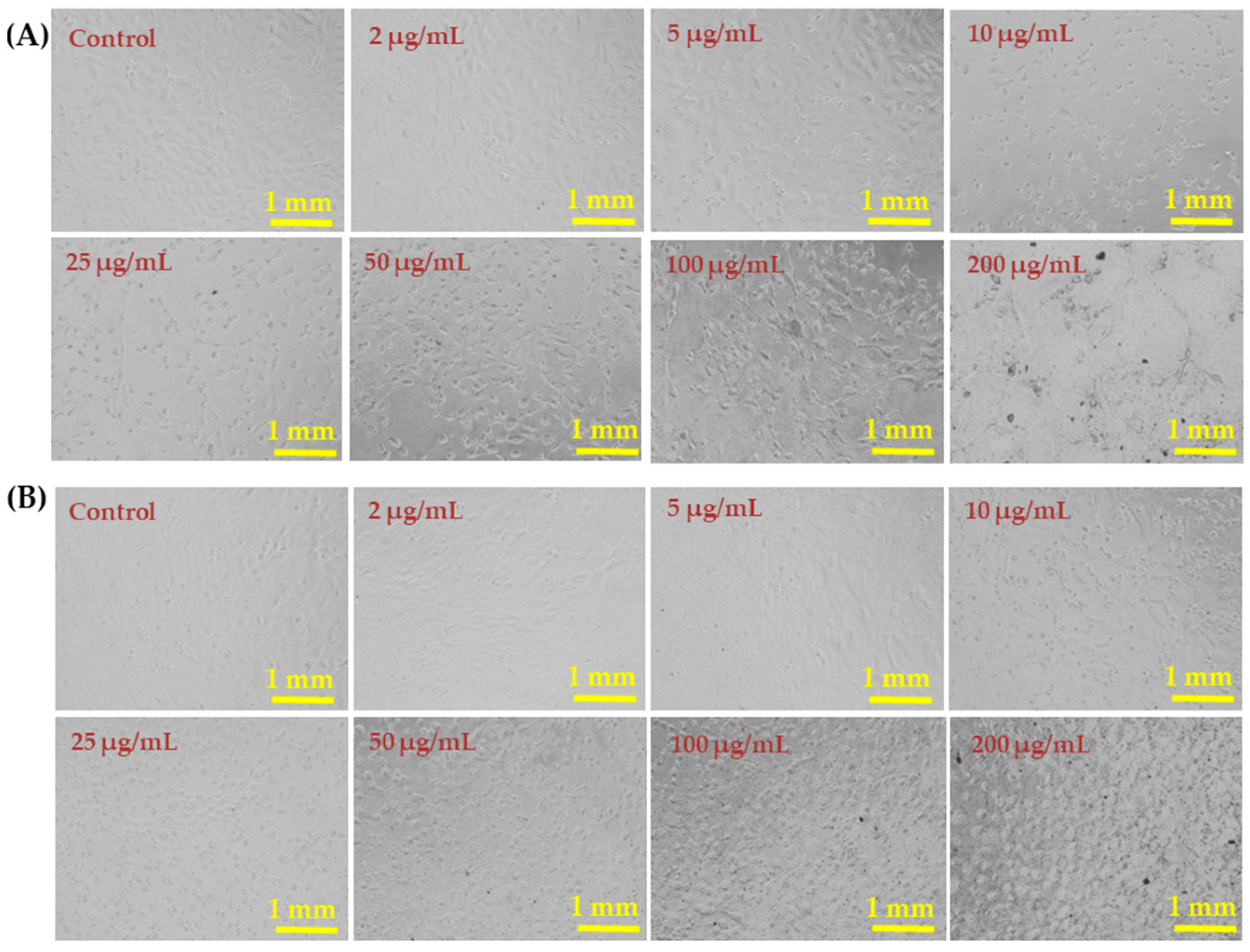 Metals 12 00148 g005