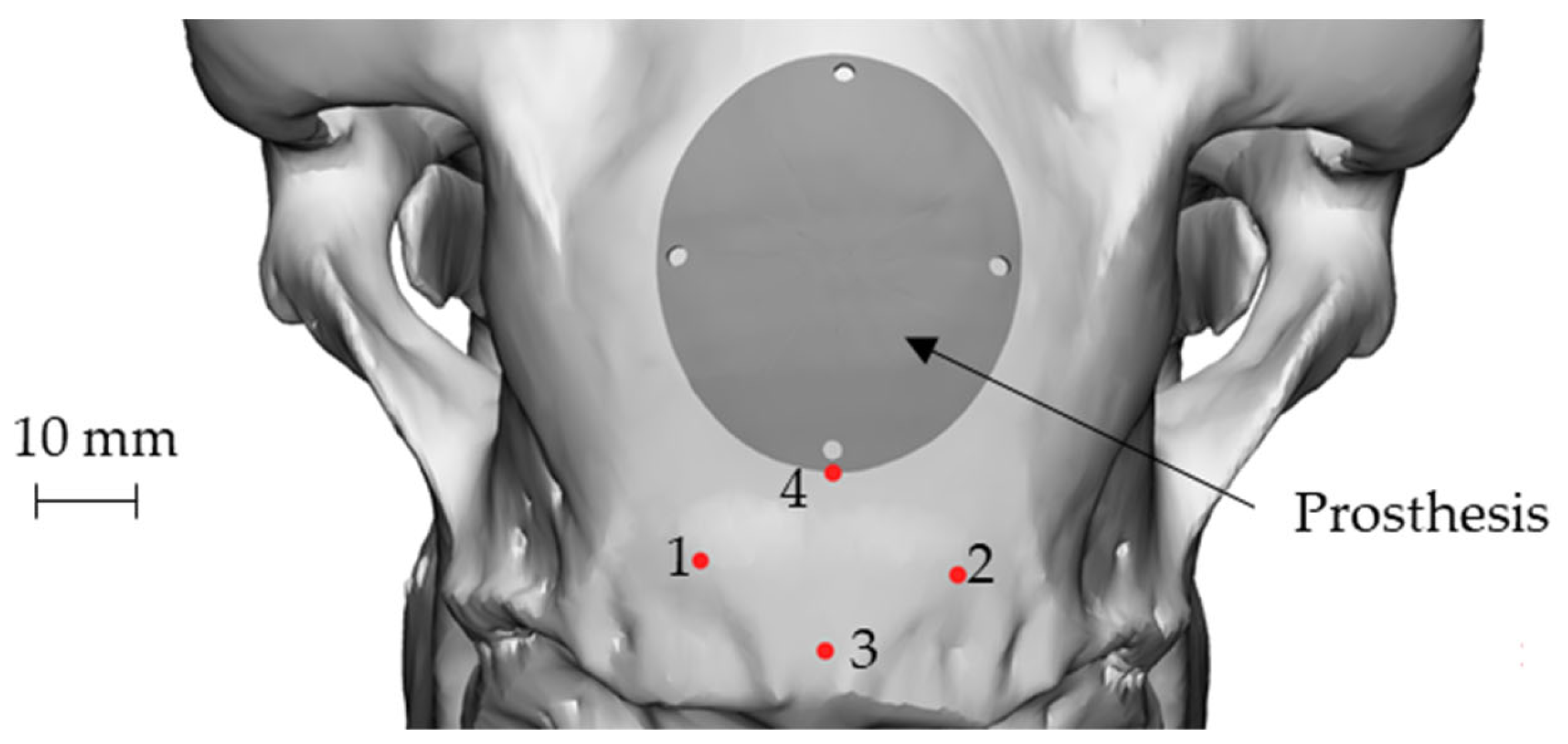 Metals 12 00293 g006