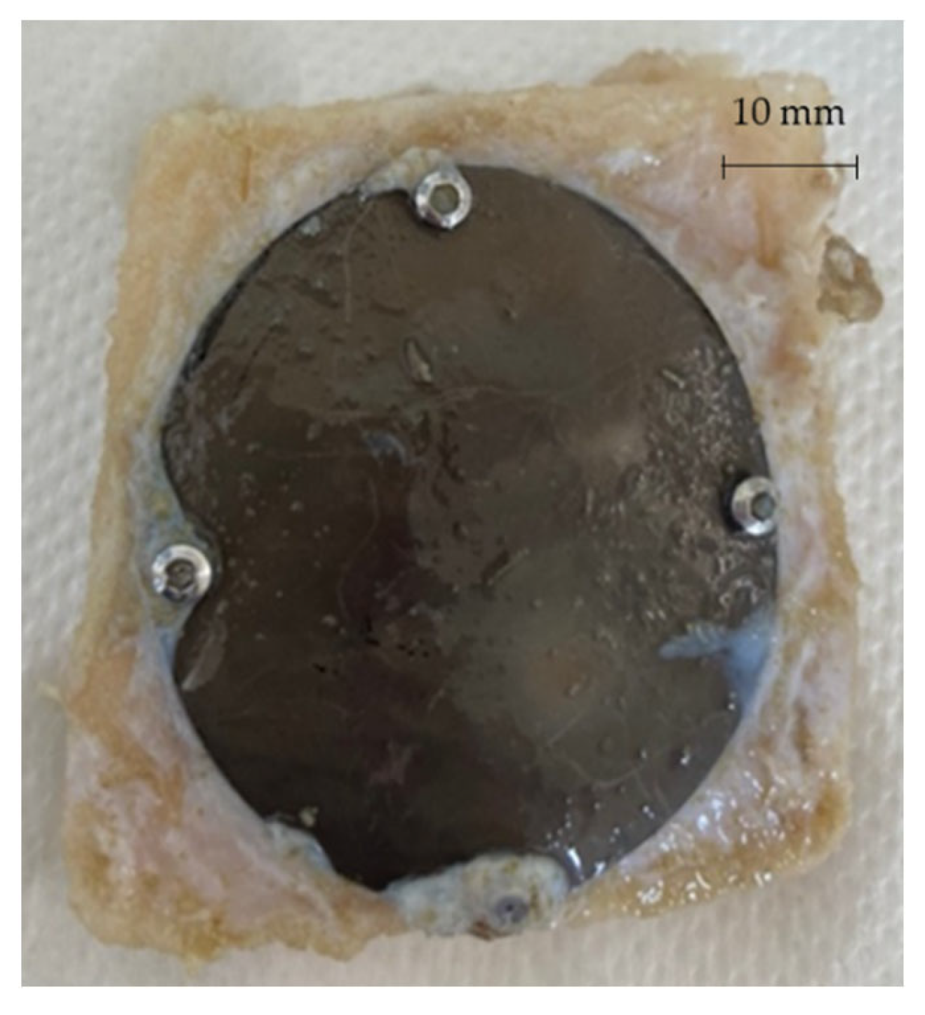 Metals 12 00293 g020