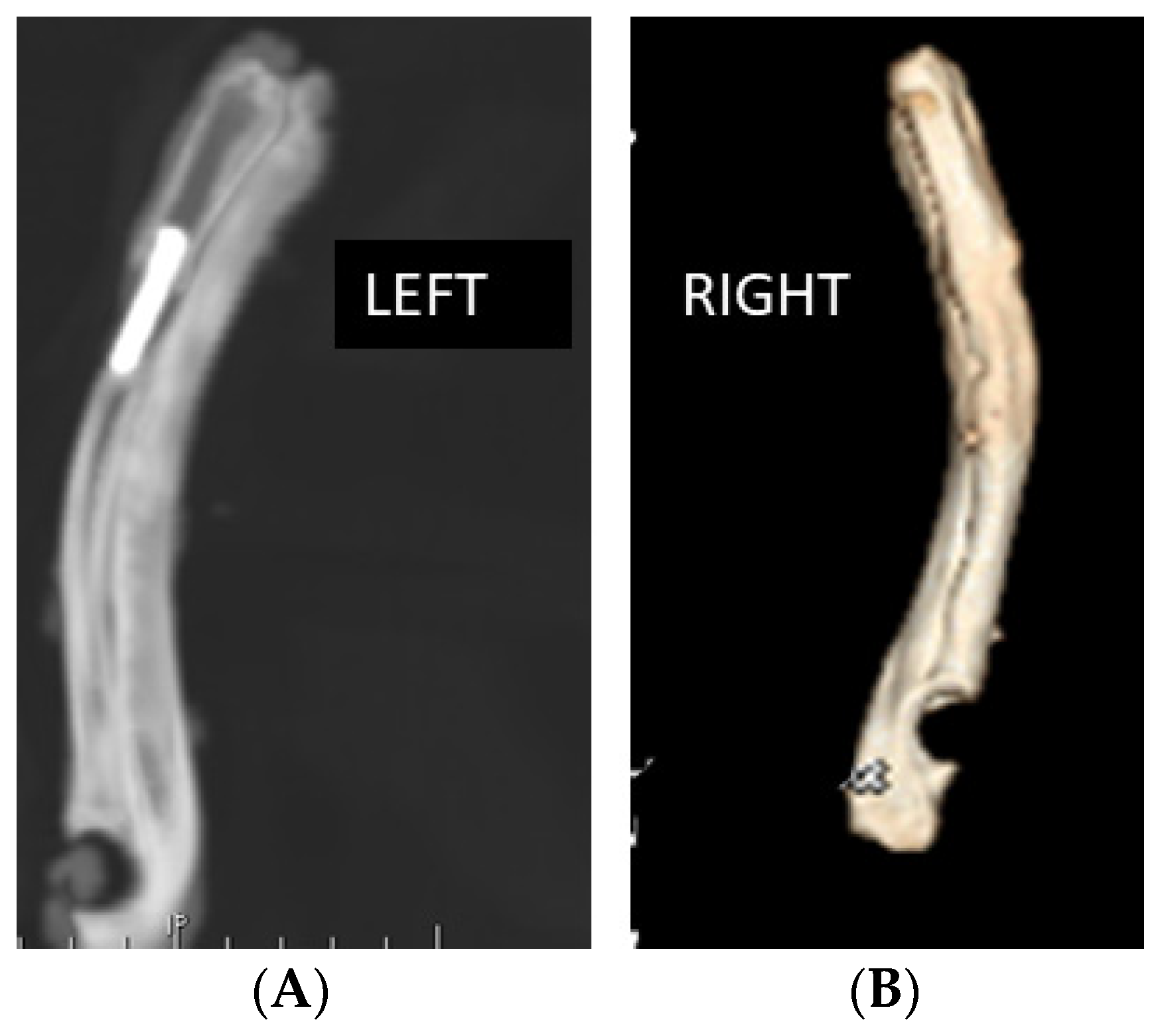 Metals 12 00327 g004