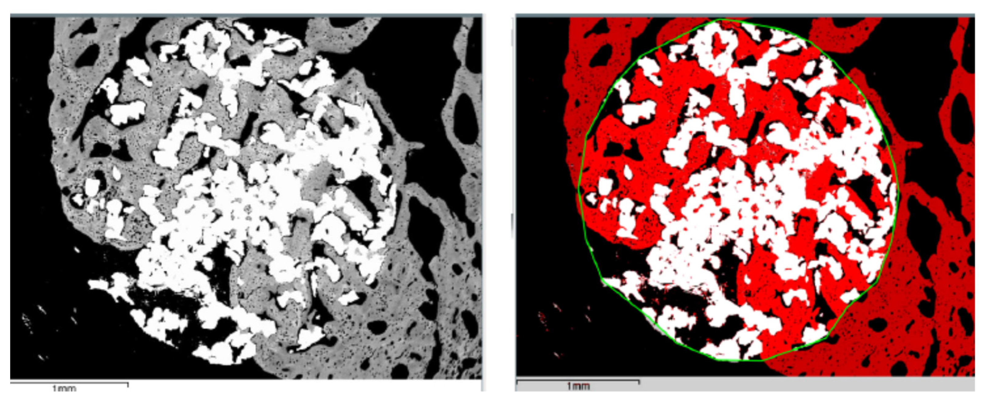 Metals 12 00327 g008