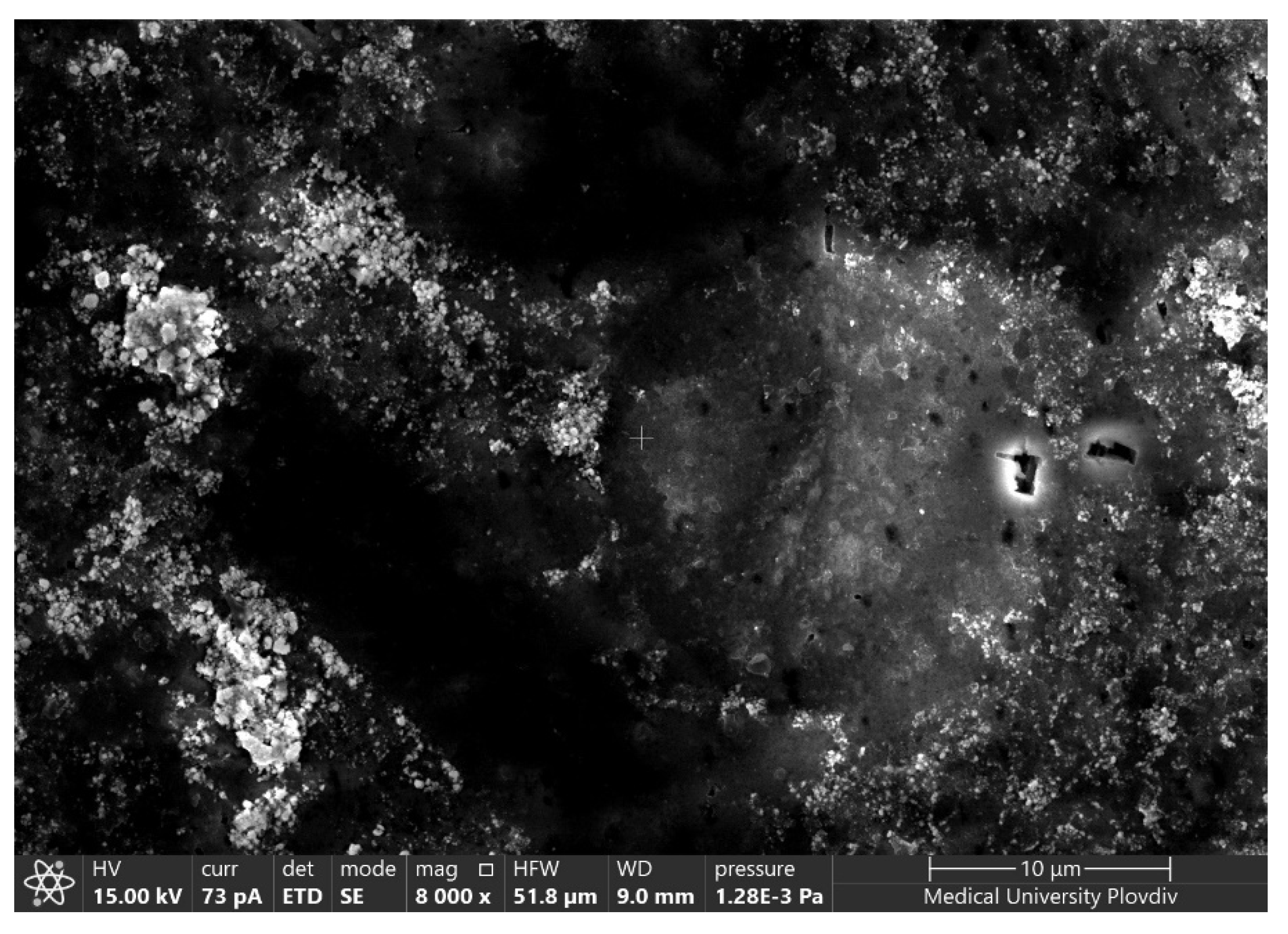 Metals 12 00474 g008 Metals 12 00474 g008