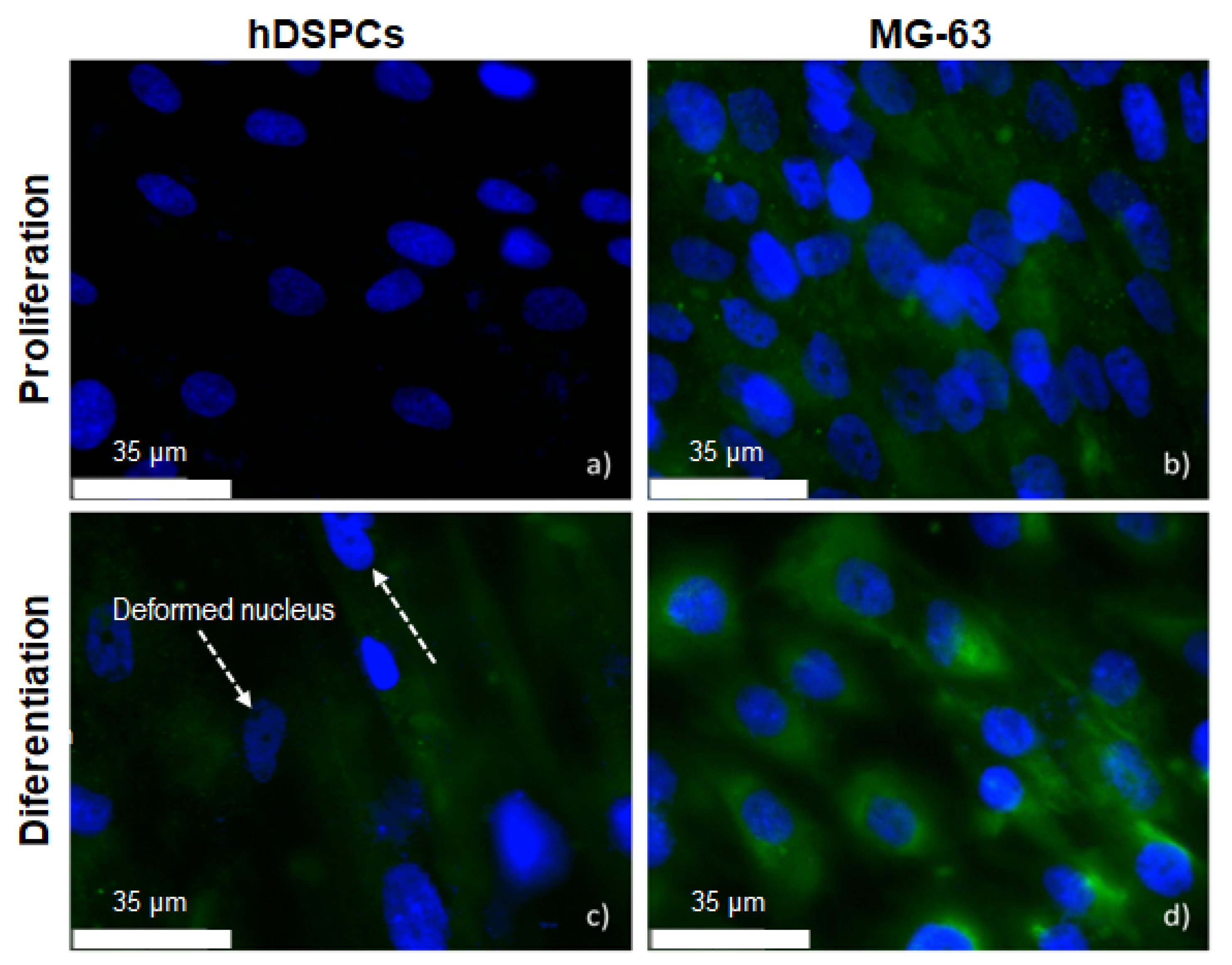 Metals 12 00476 g011