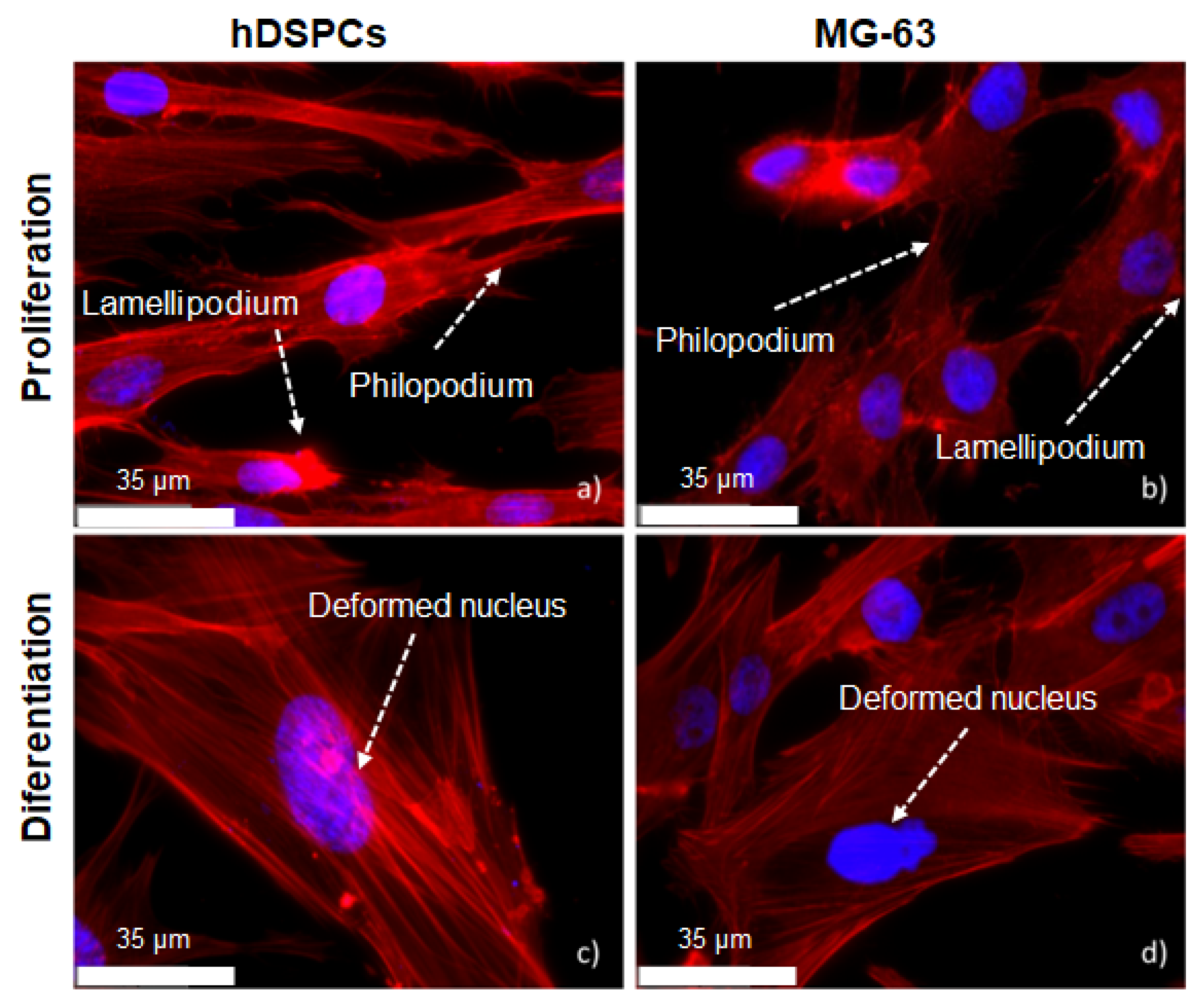 Metals 12 00476 g015