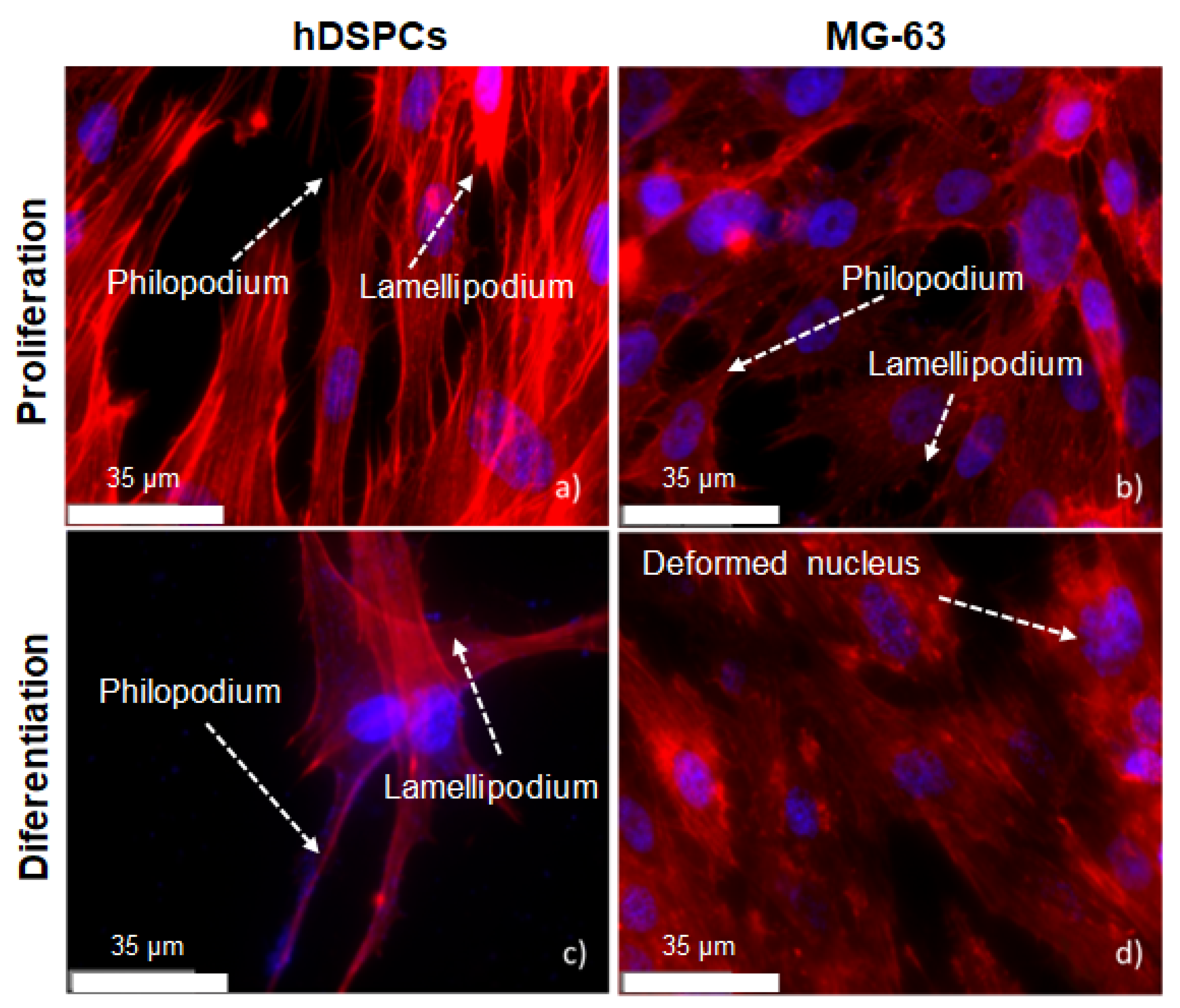 Metals 12 00476 g016