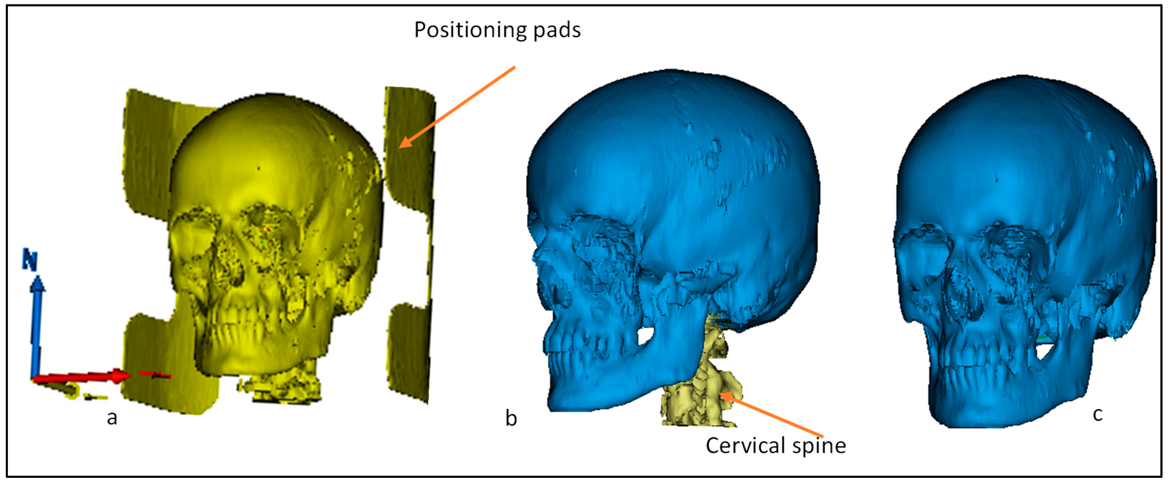 Metals 12 00552 g002