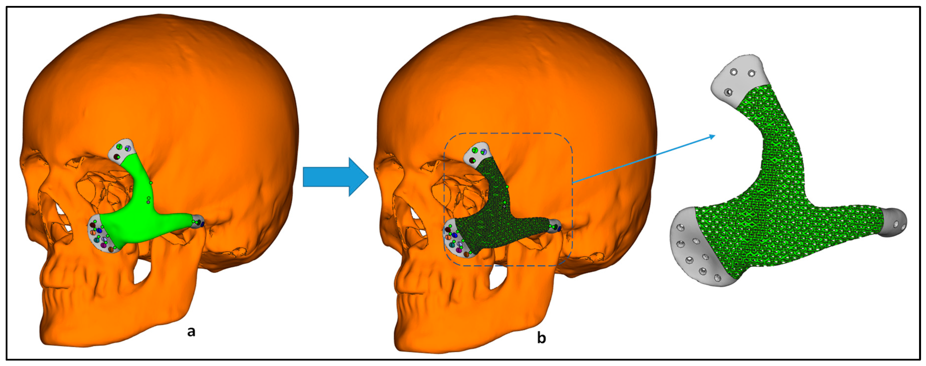Metals 12 00552 g005