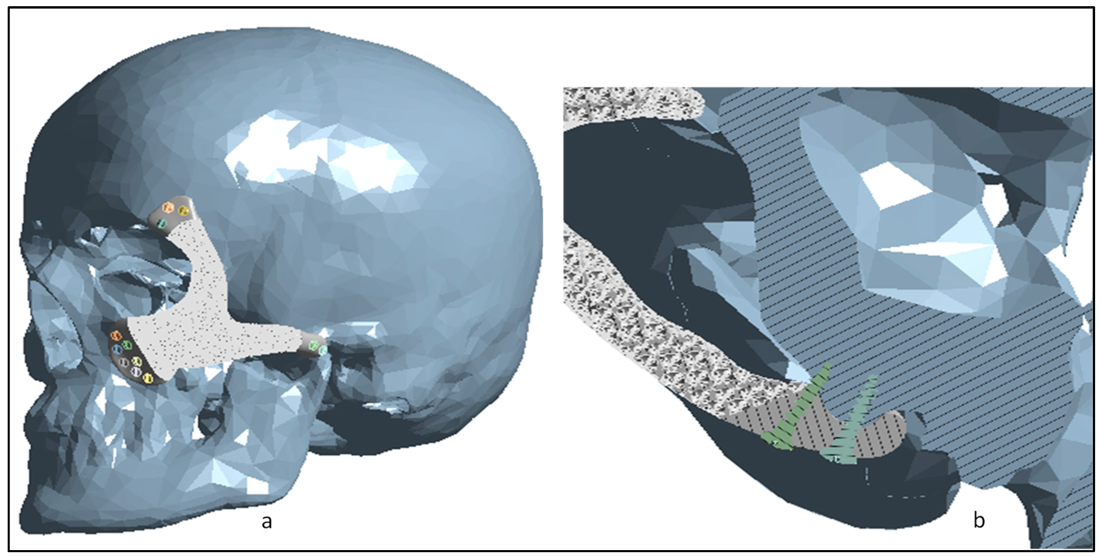 Metals 12 00552 g009