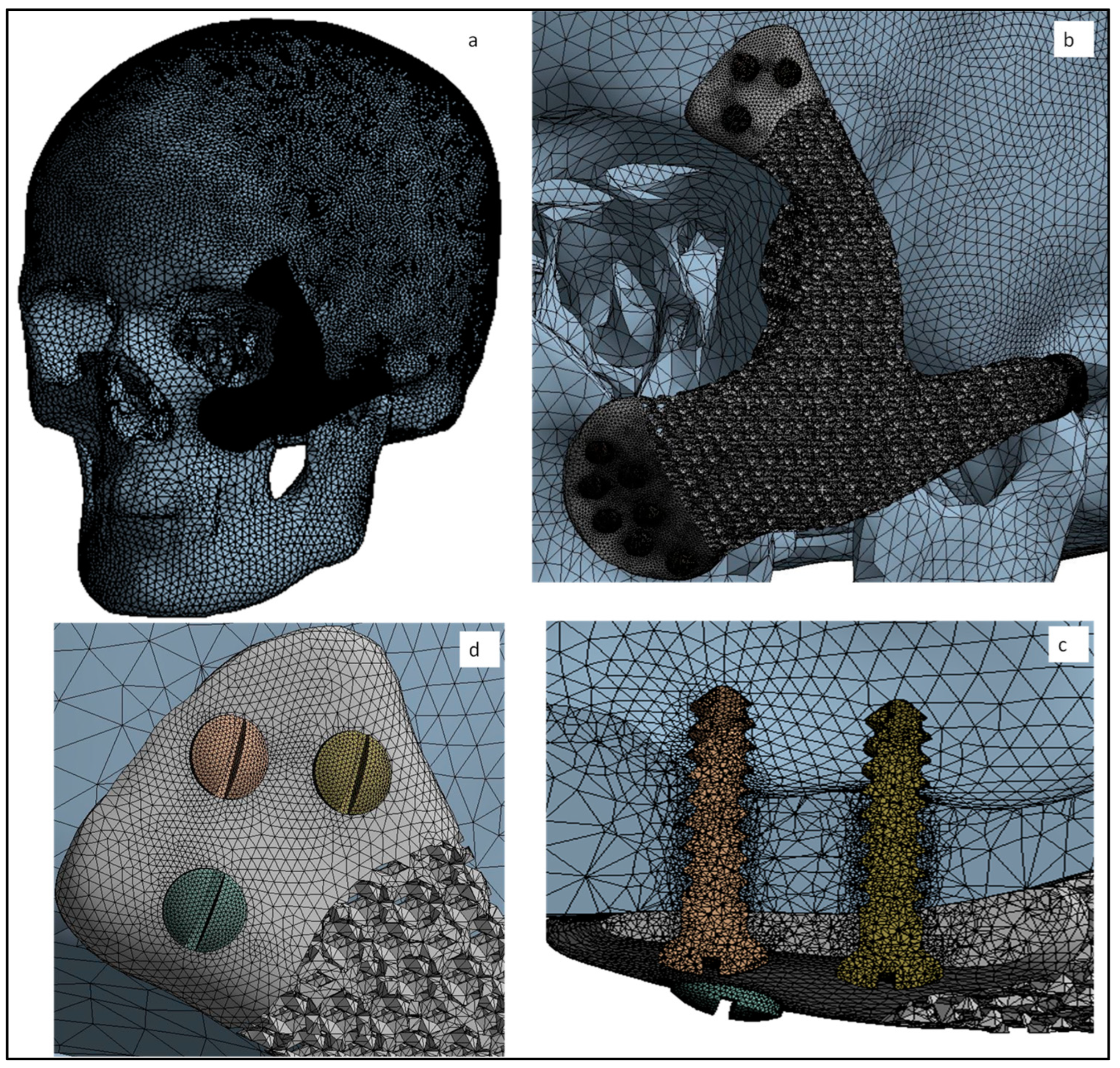 Metals 12 00552 g011