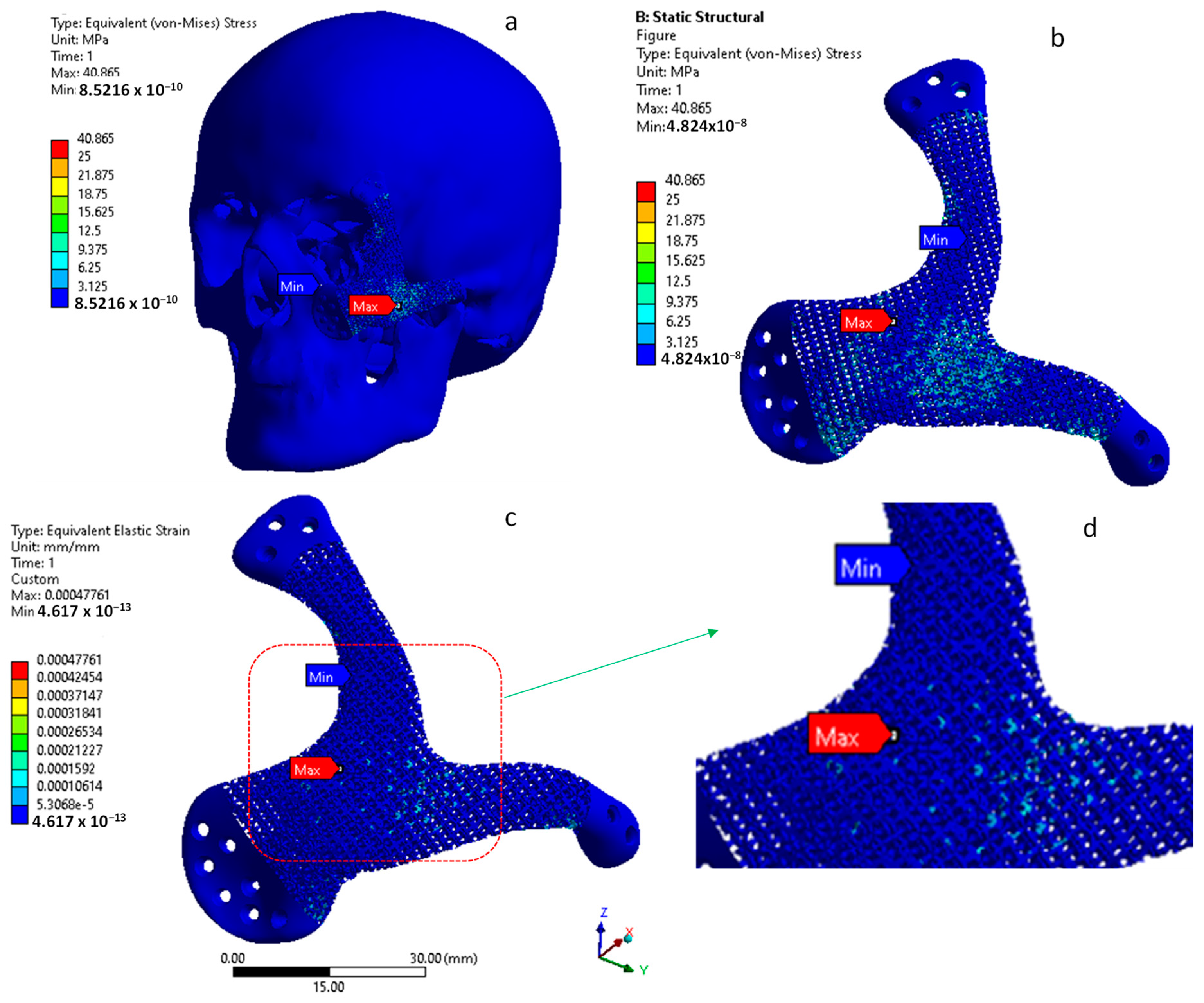 Metals 12 00552 g013