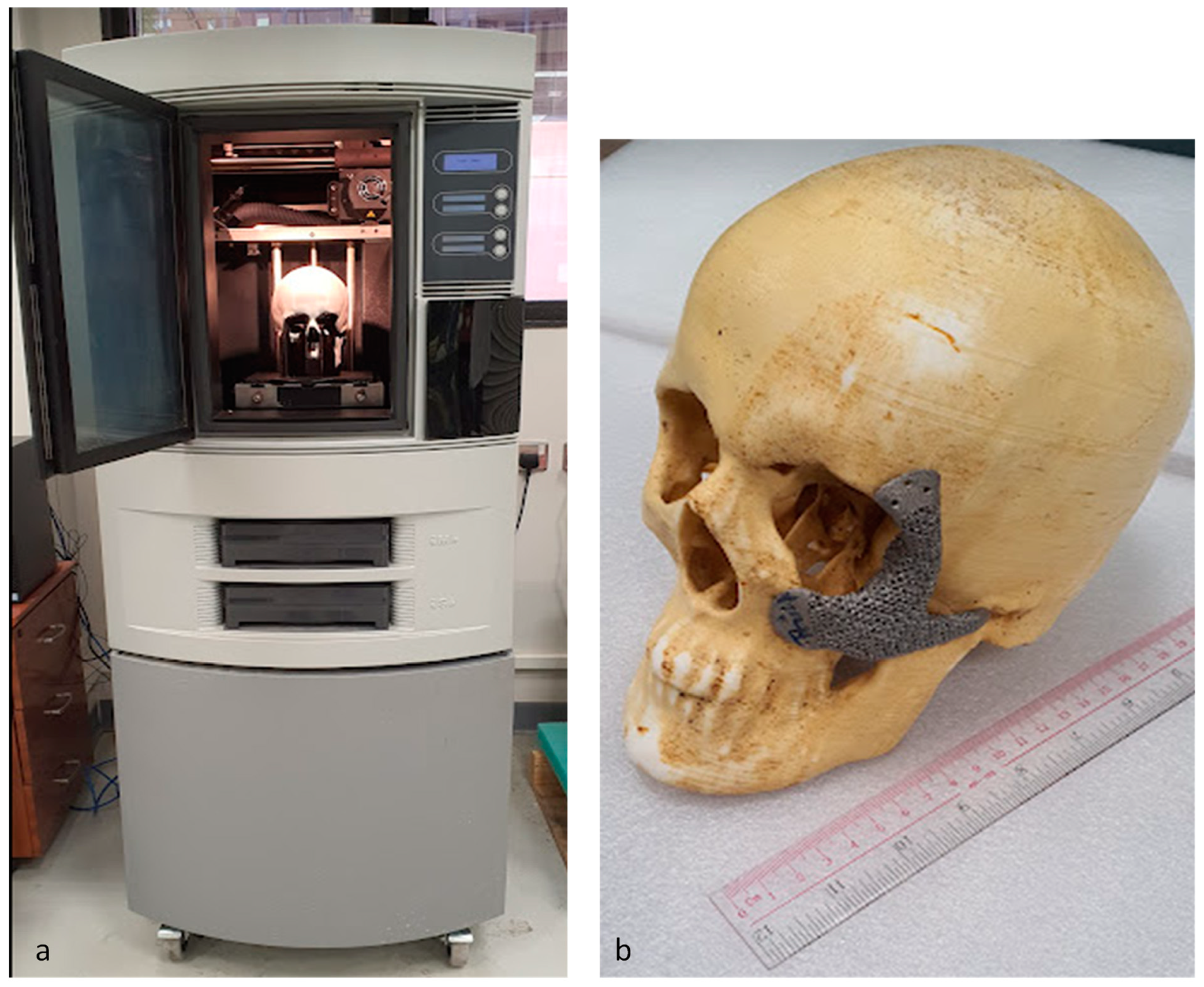 Metals 12 00552 g014