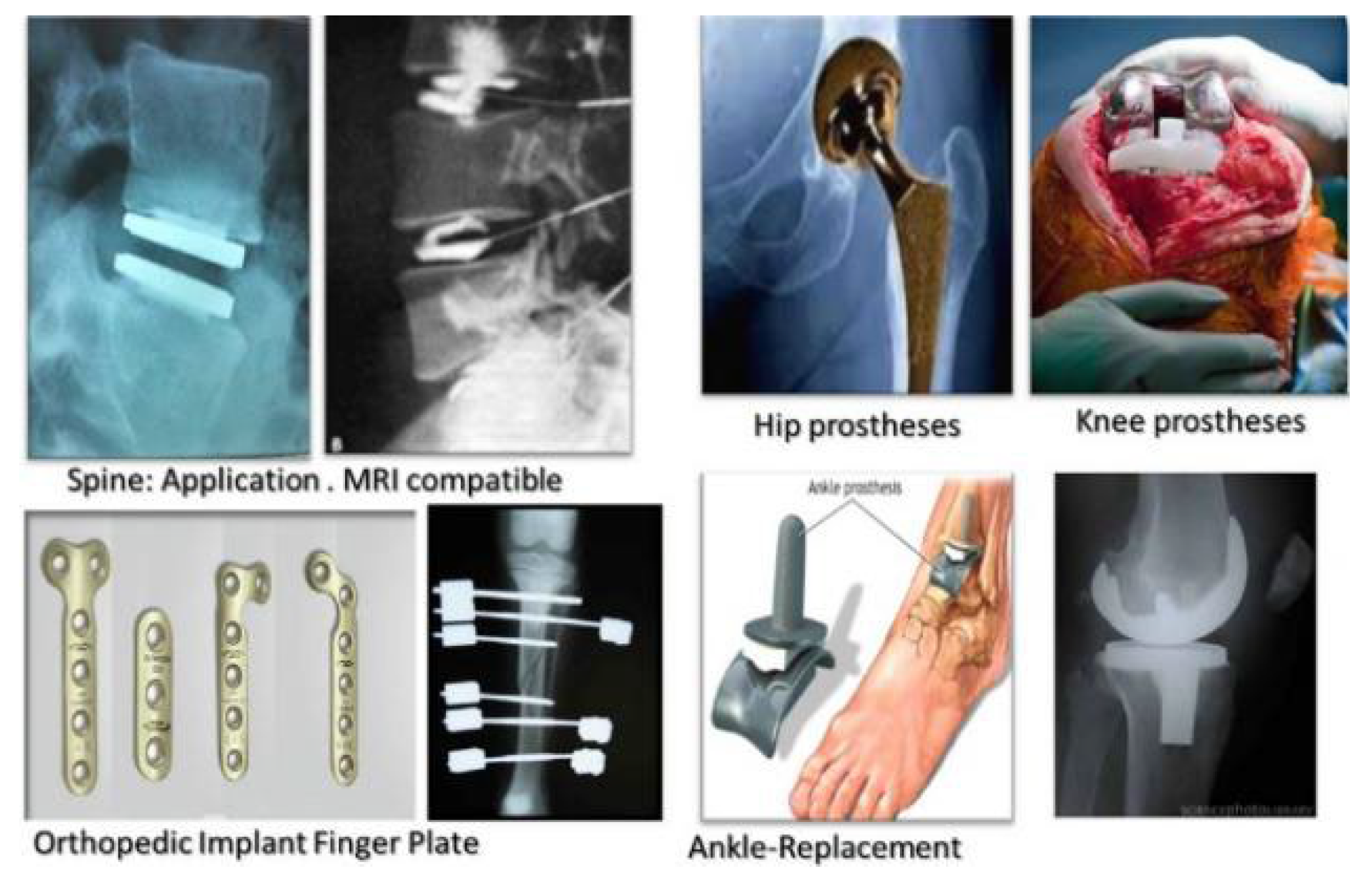 Metals 12 00829 g001