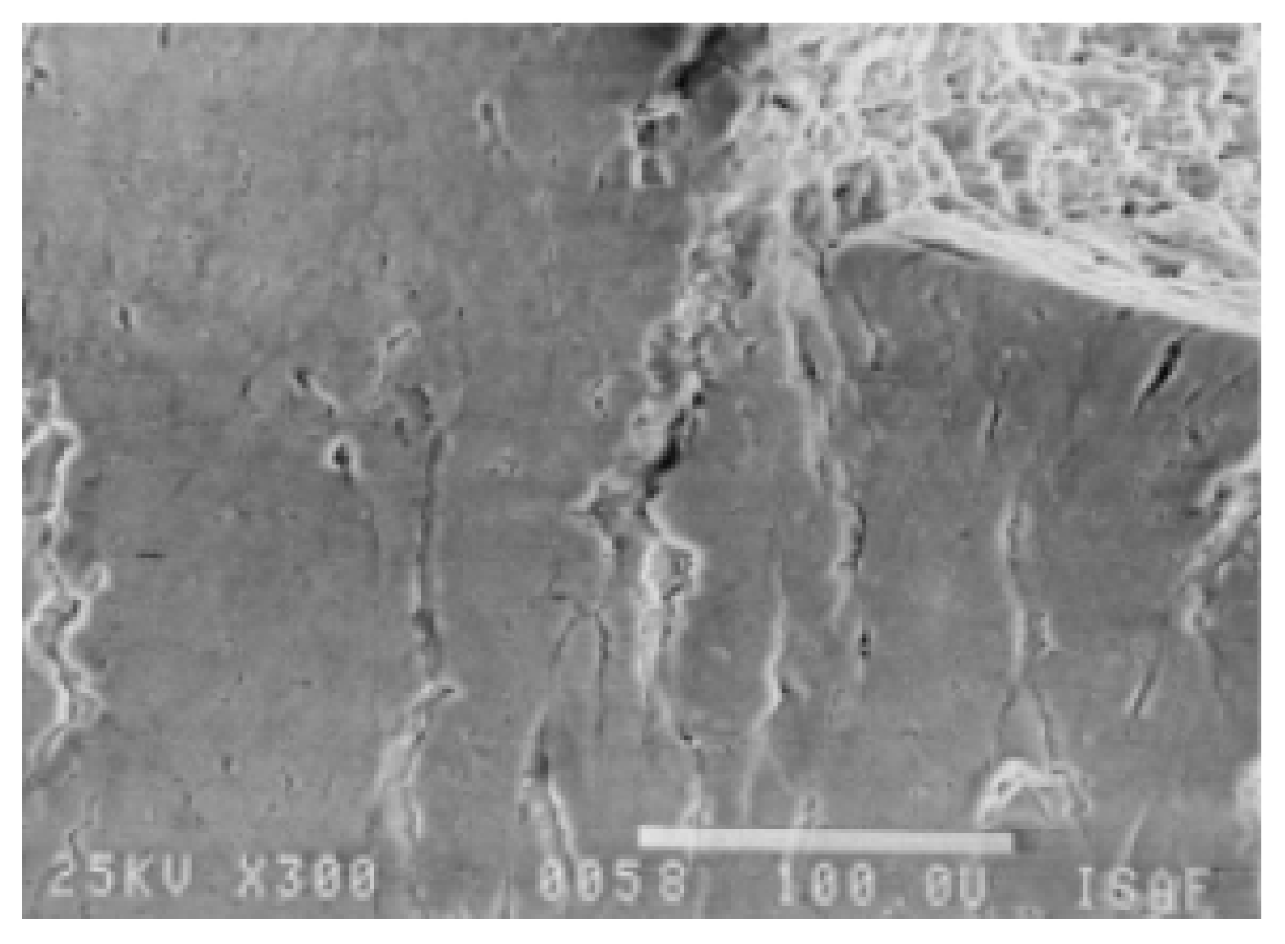 Metals 12 01072 g015