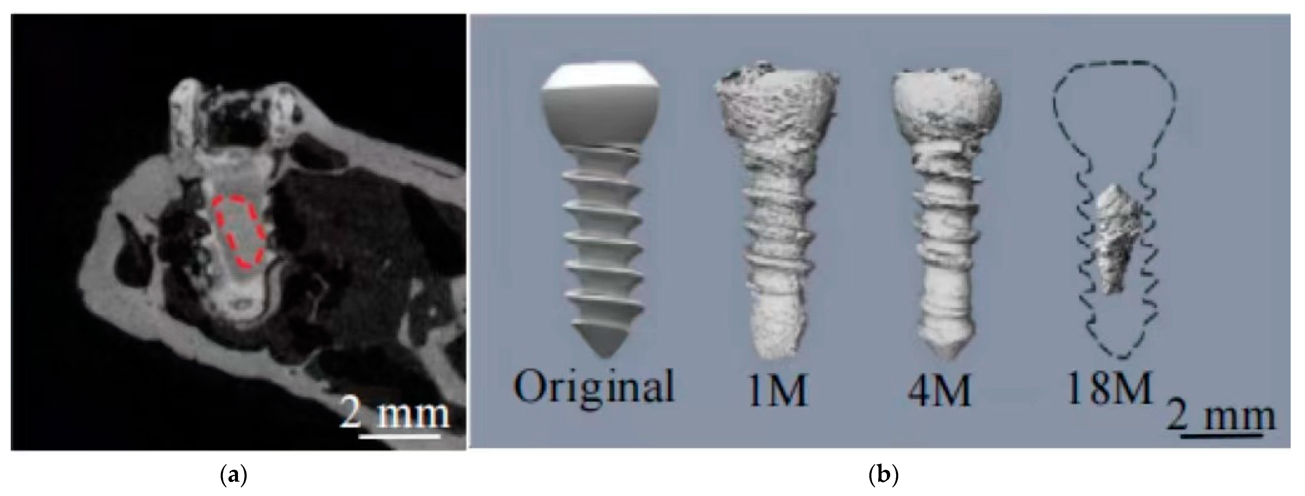Metals 12 01500 g012
