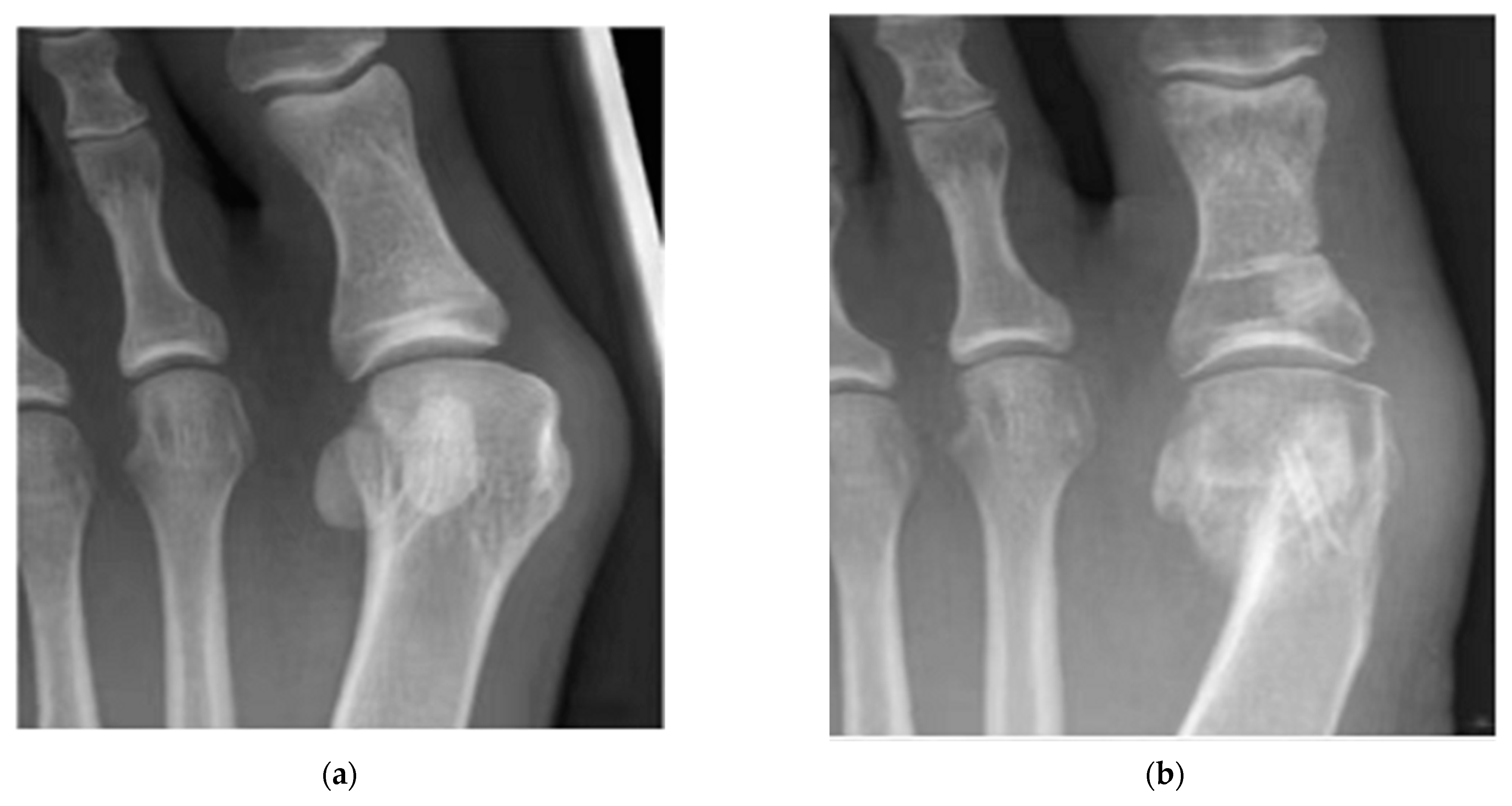 Metals 12 01500 g013a