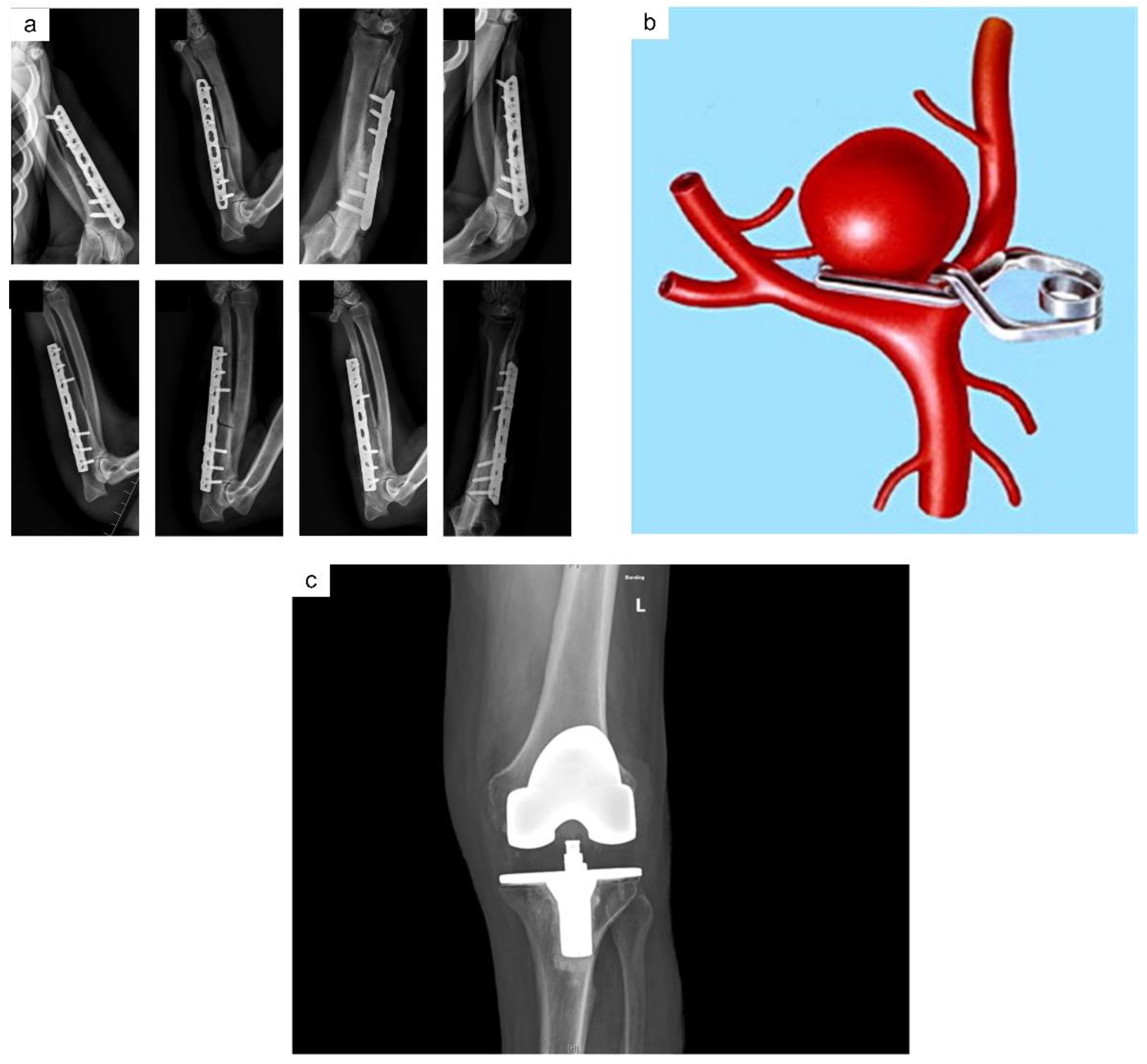 Metals 13 00194 g002